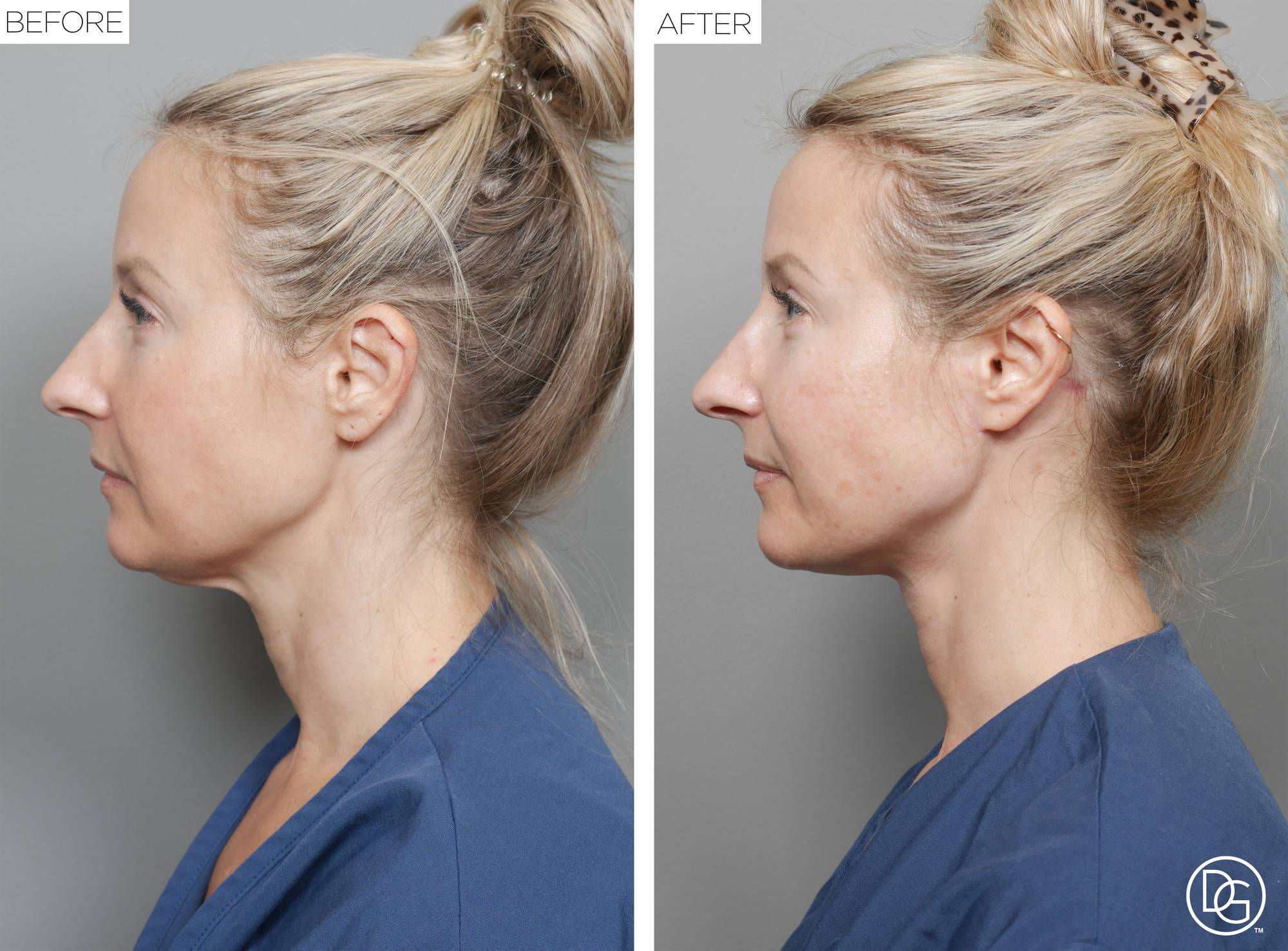 Before & After Image