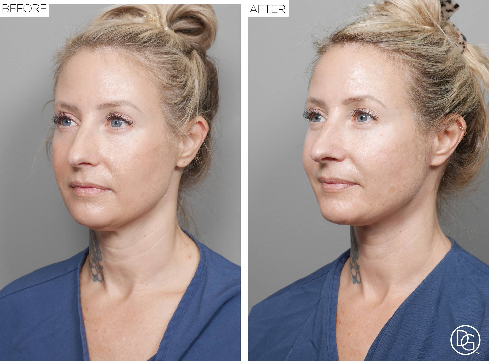 Before & After Image