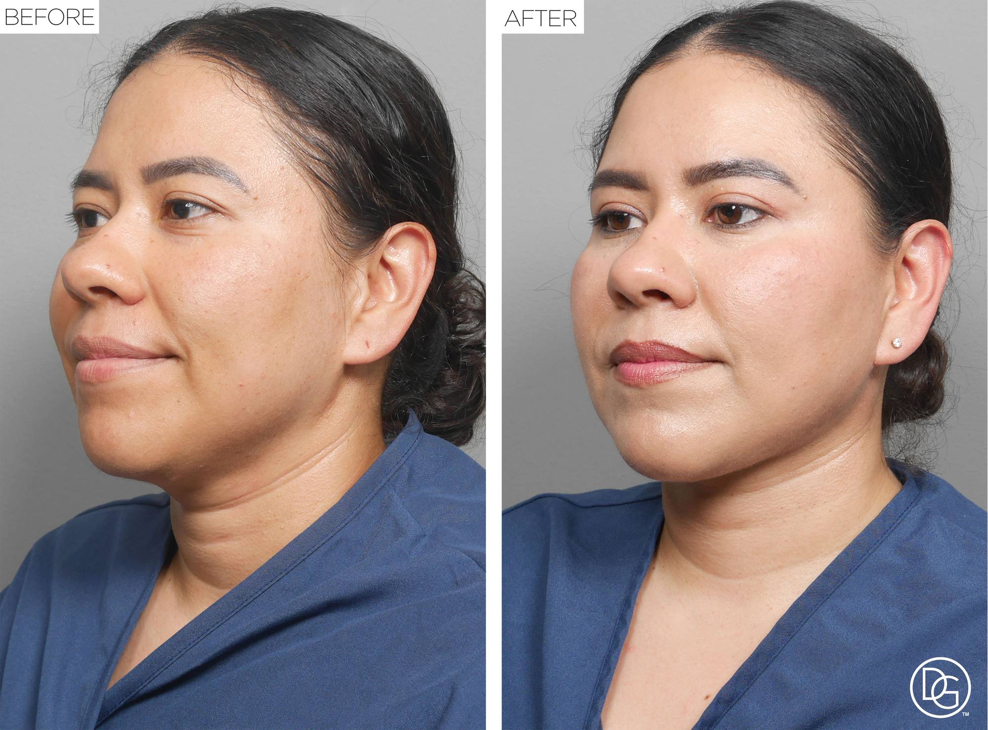 Before & After Image