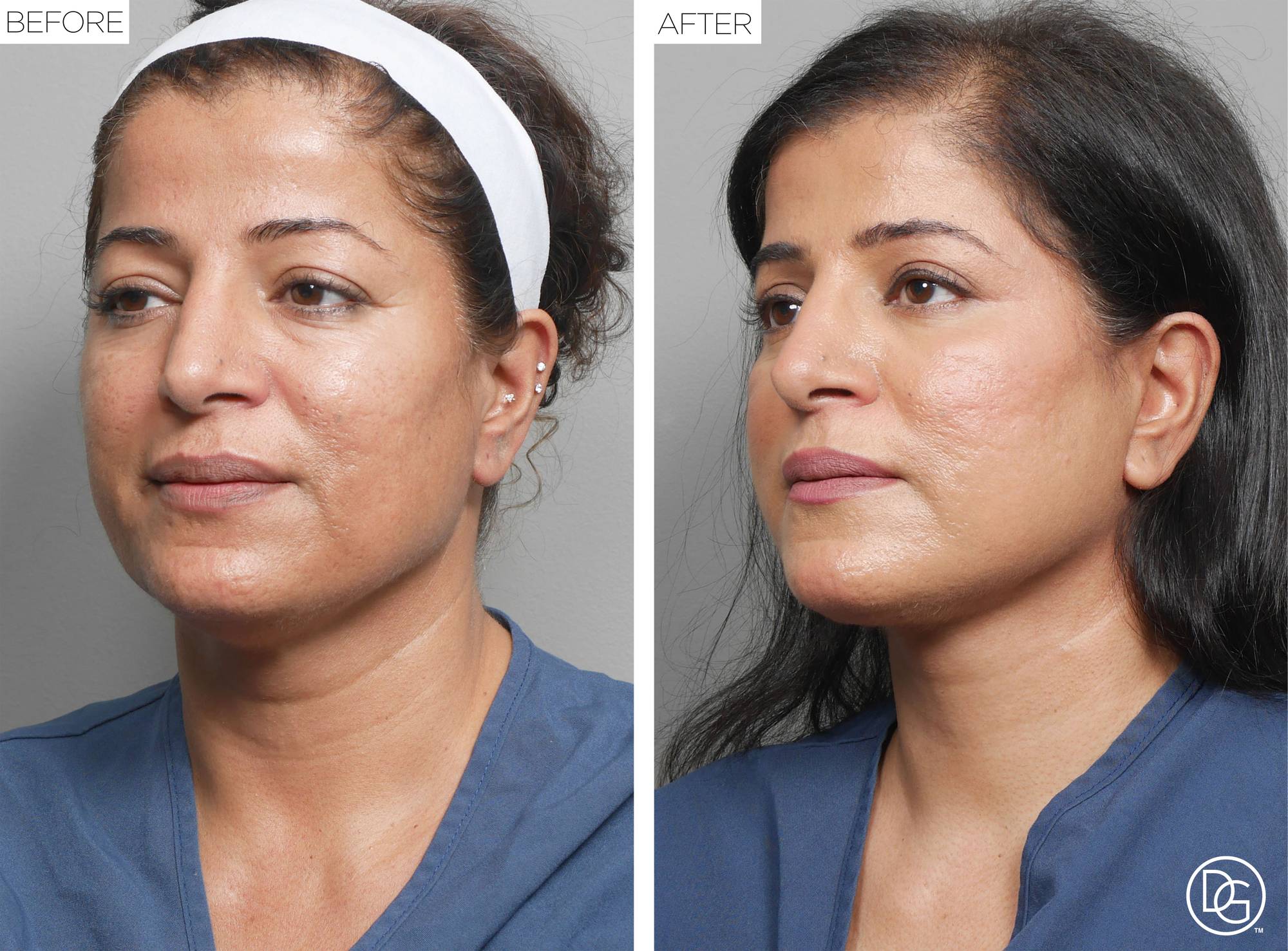 Before & After Image