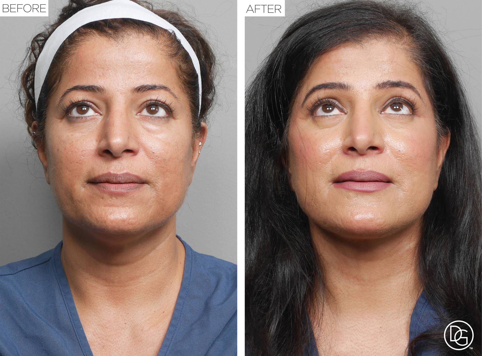 Before & After Image