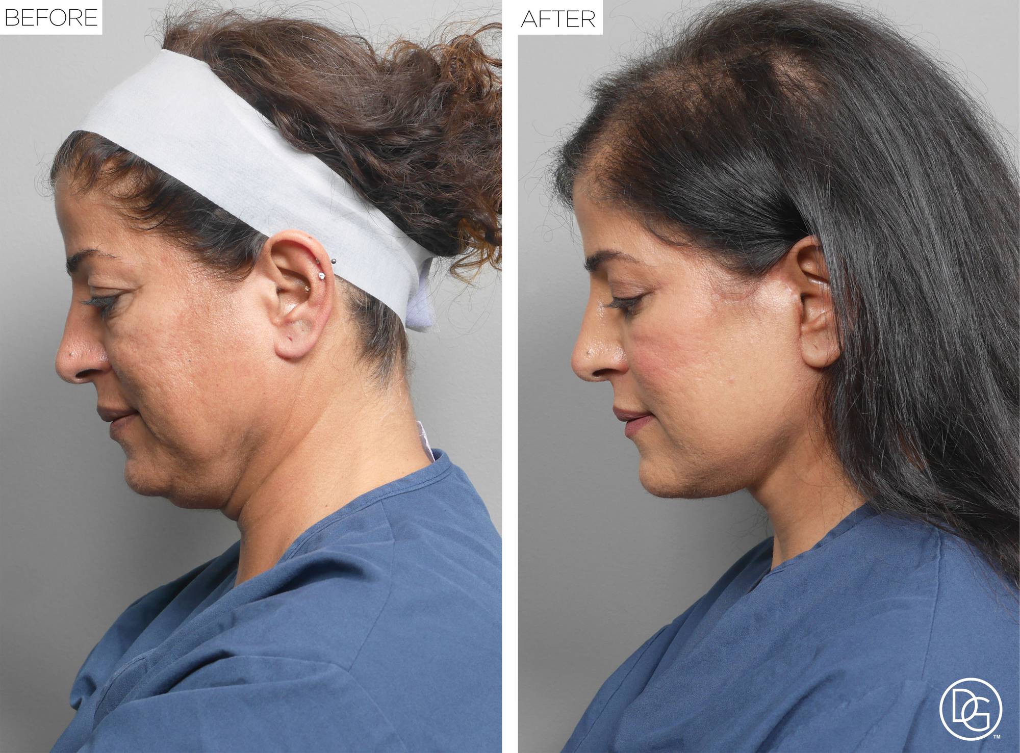 Before & After Image