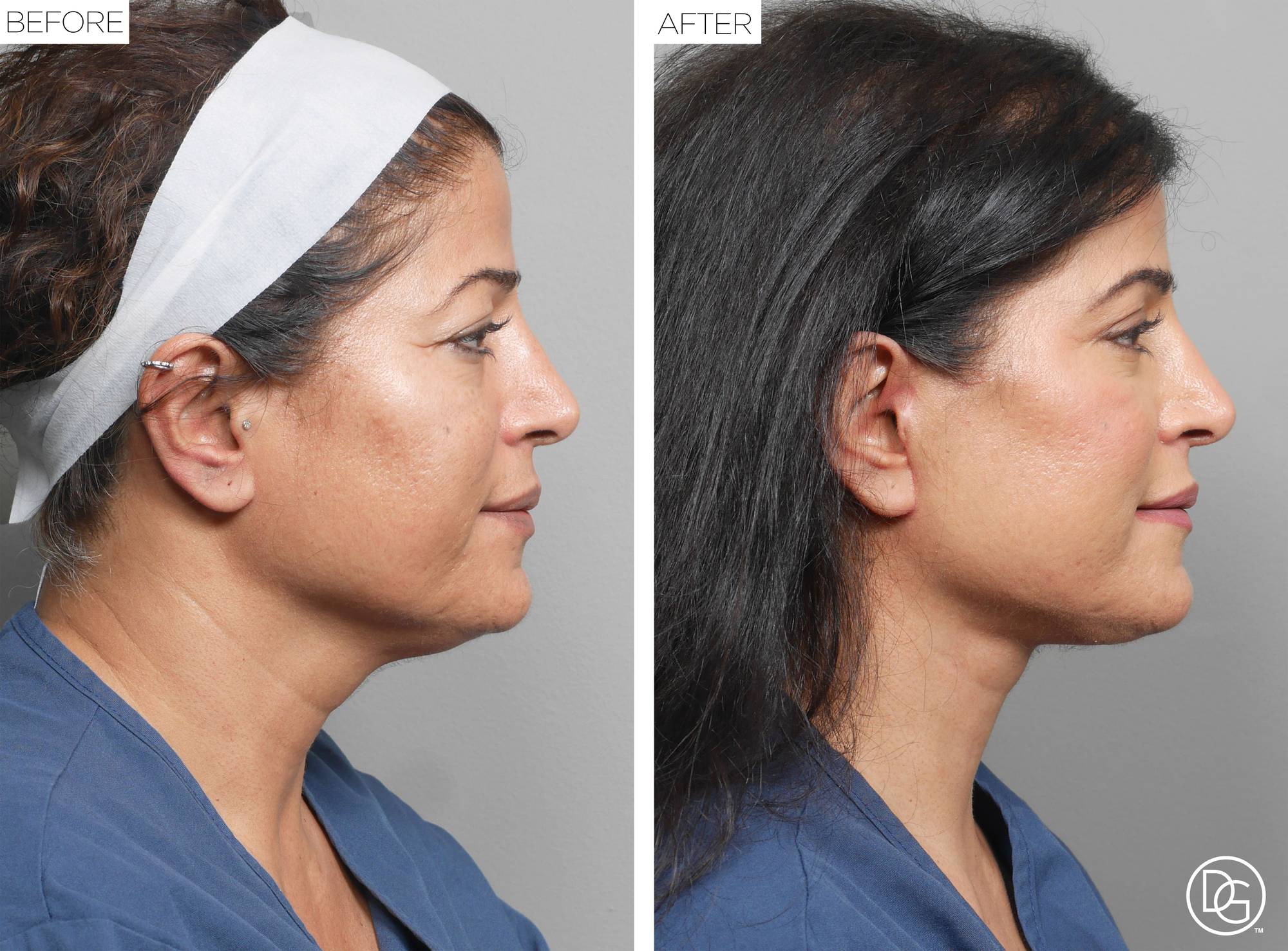 Before & After Image