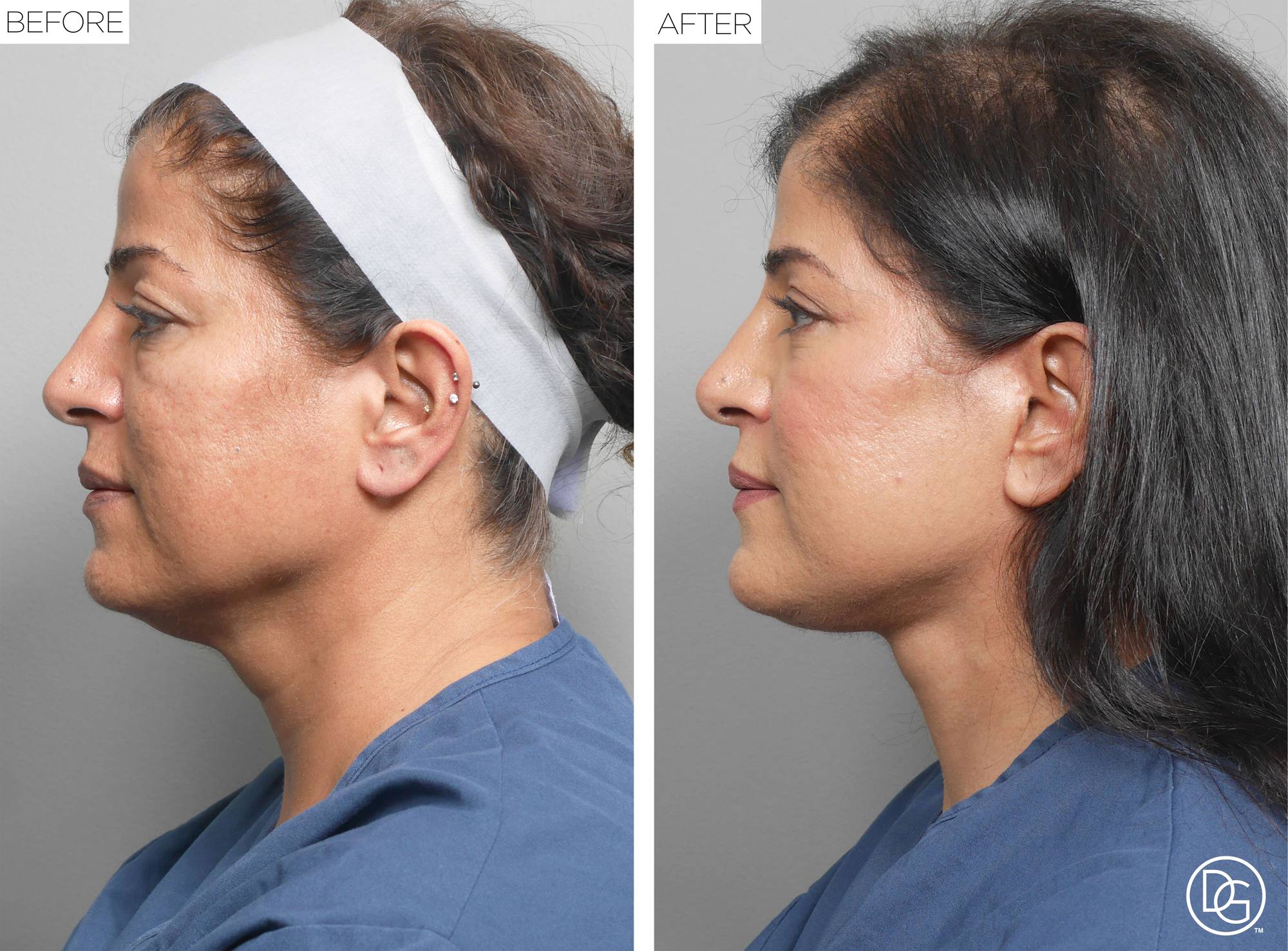 Before & After Image