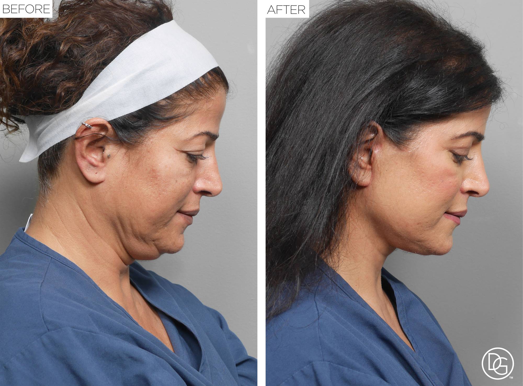 Before & After Image