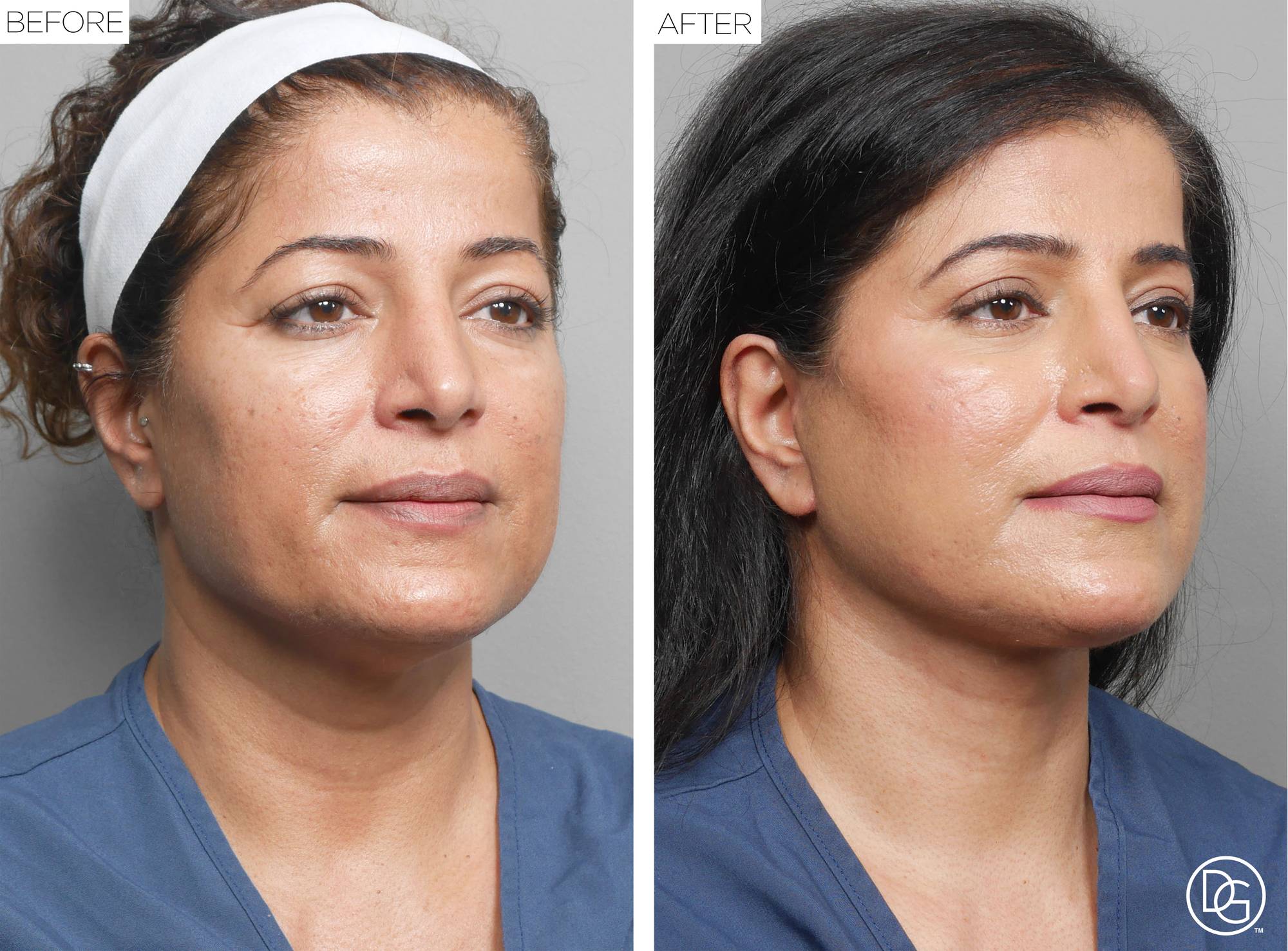 Before & After Image