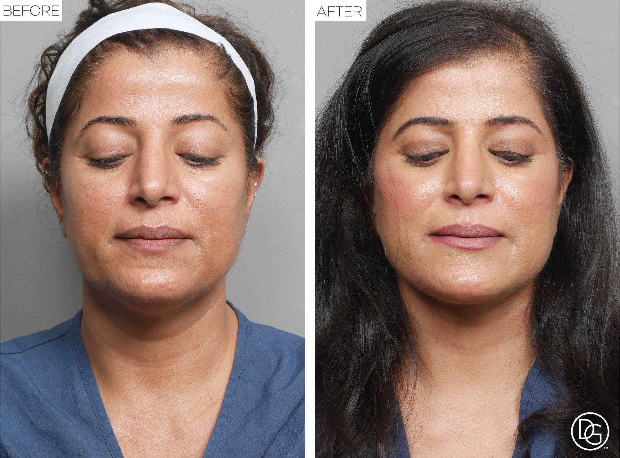 Before & After Image