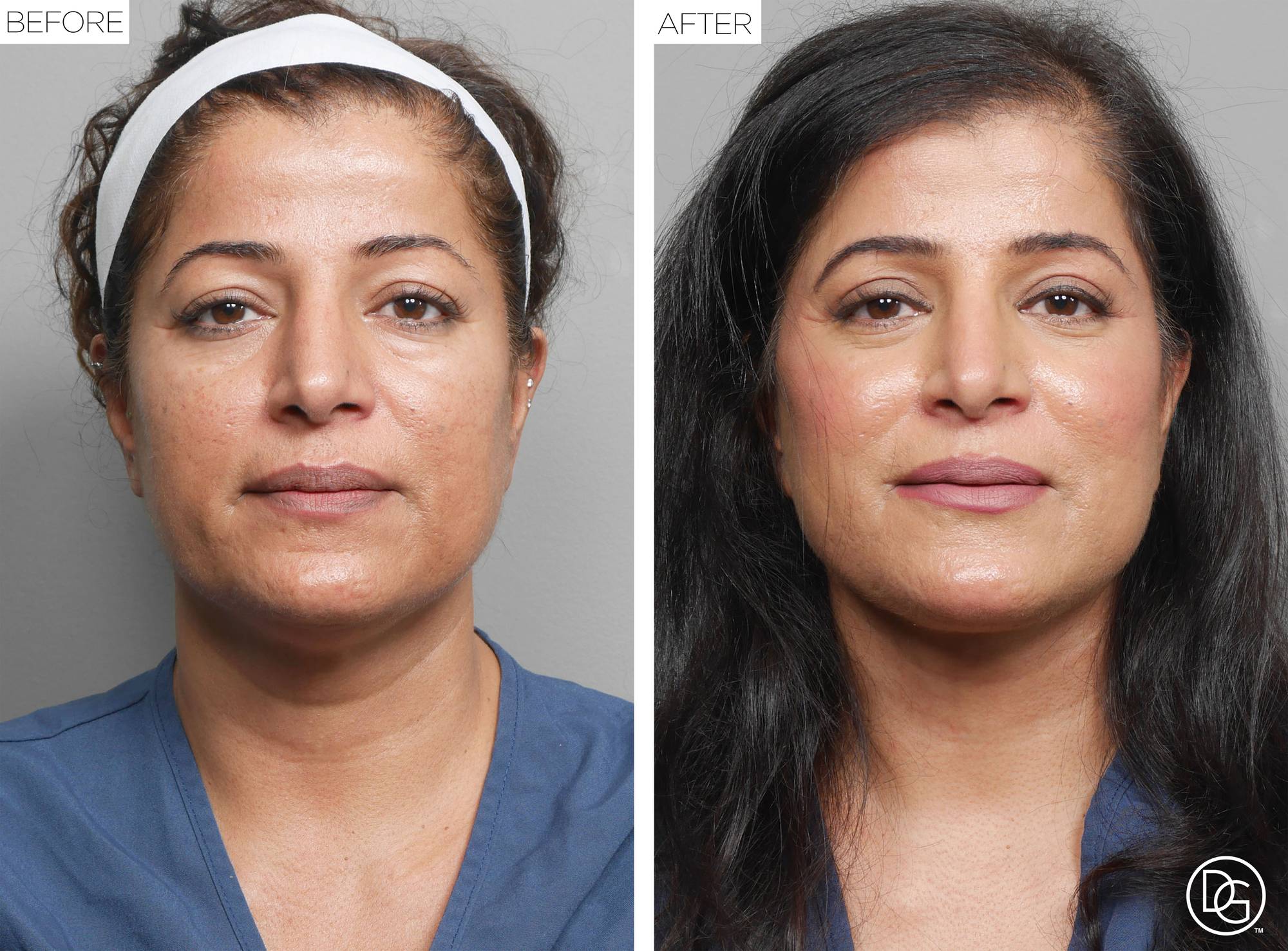 Before & After Image