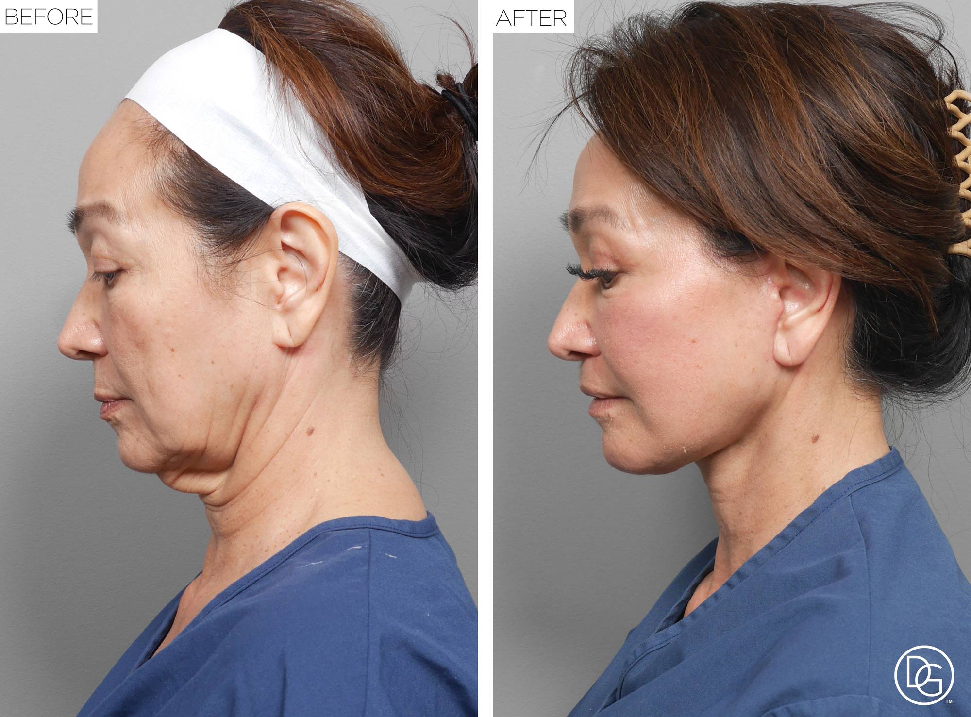 Before & After Image