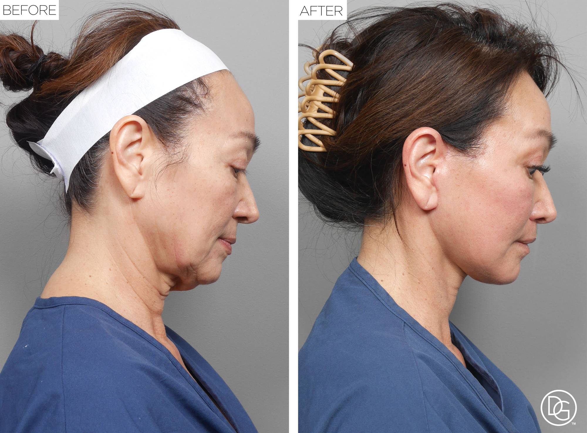 Before & After Image