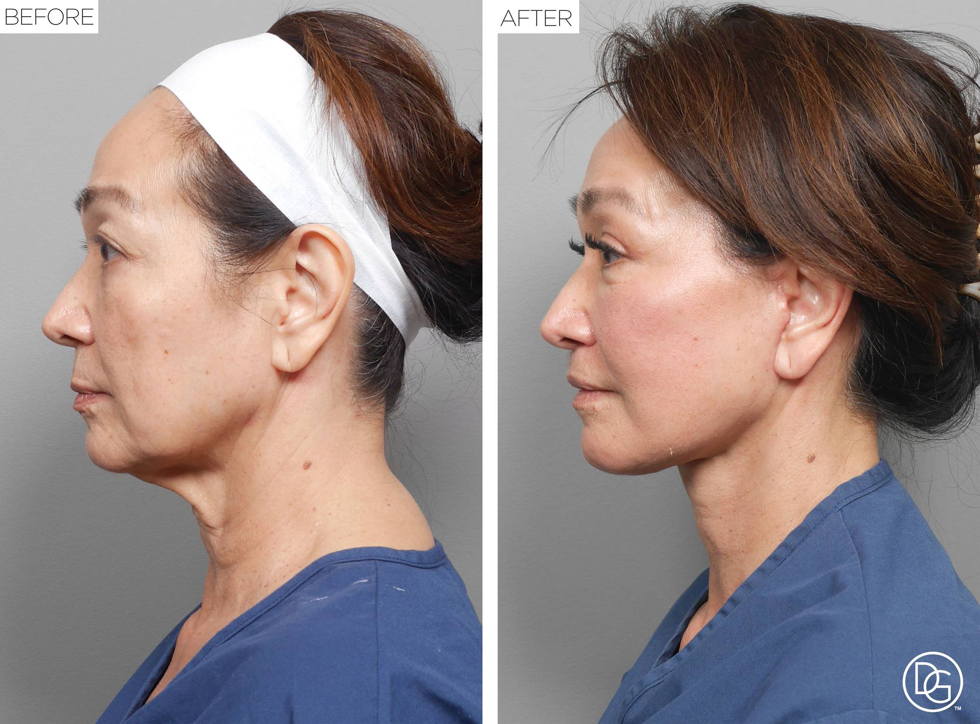 Before & After Image