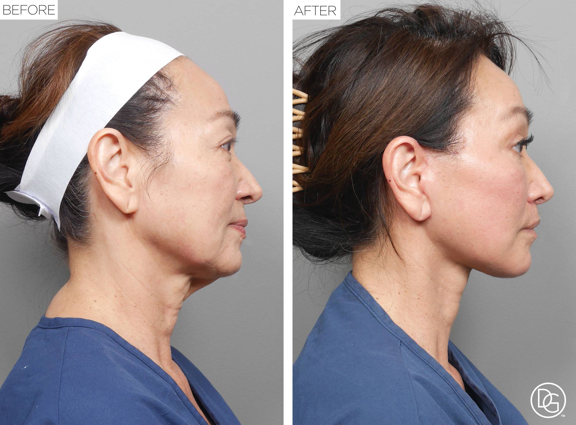 Before & After Image