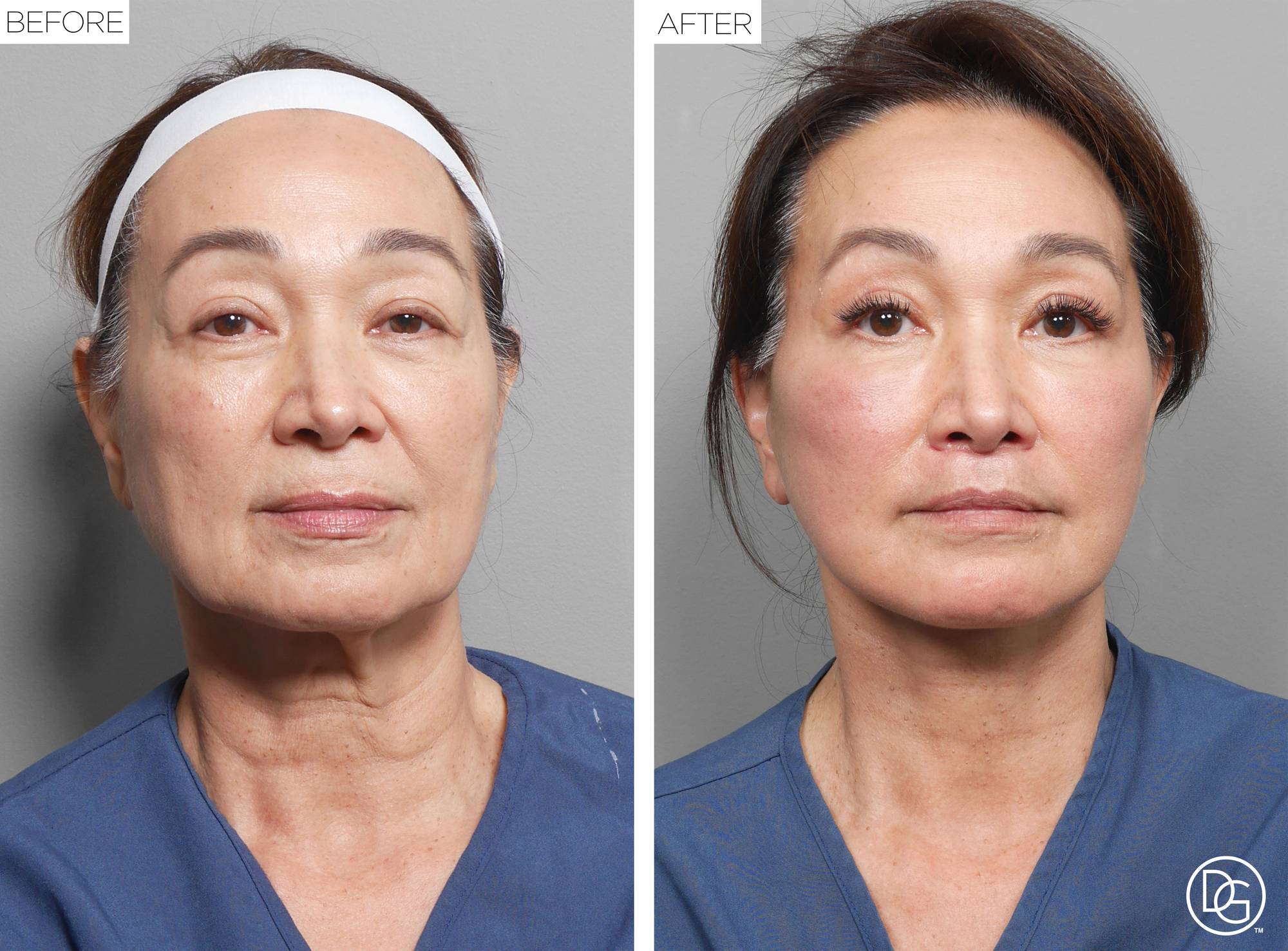 Before & After Image