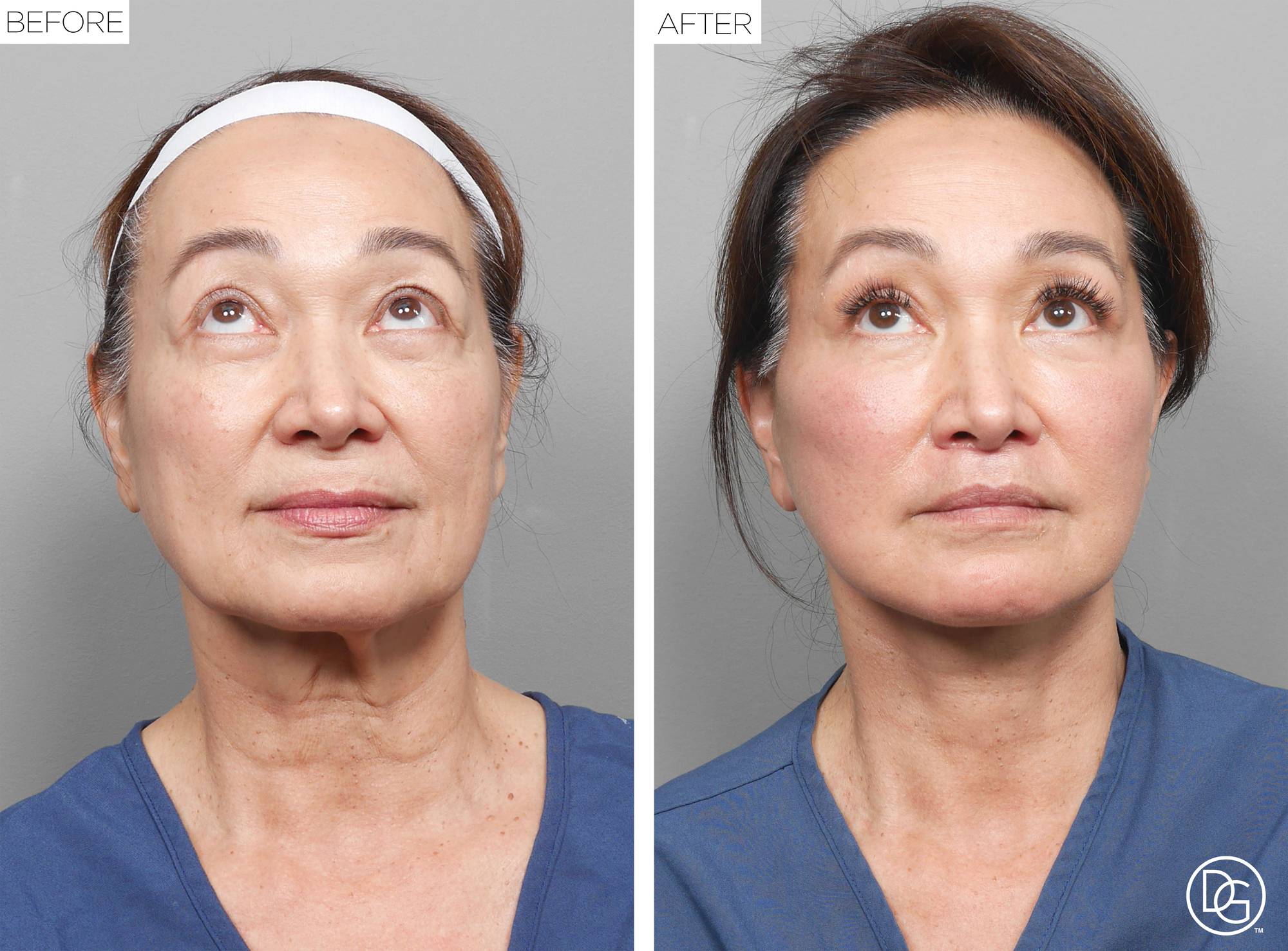 Before & After Image