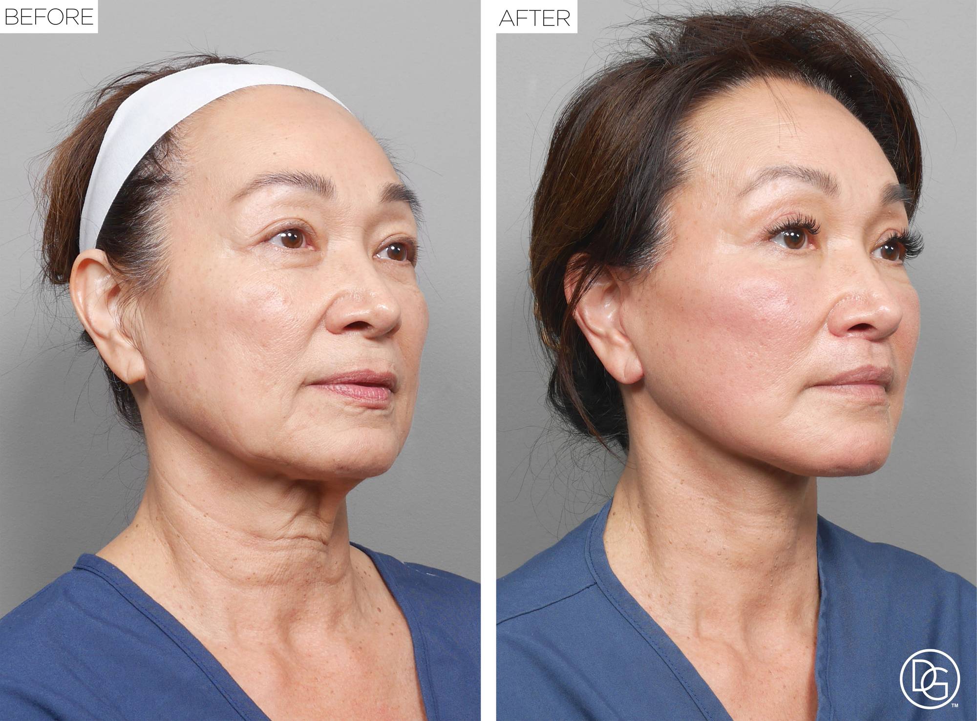 Before & After Image