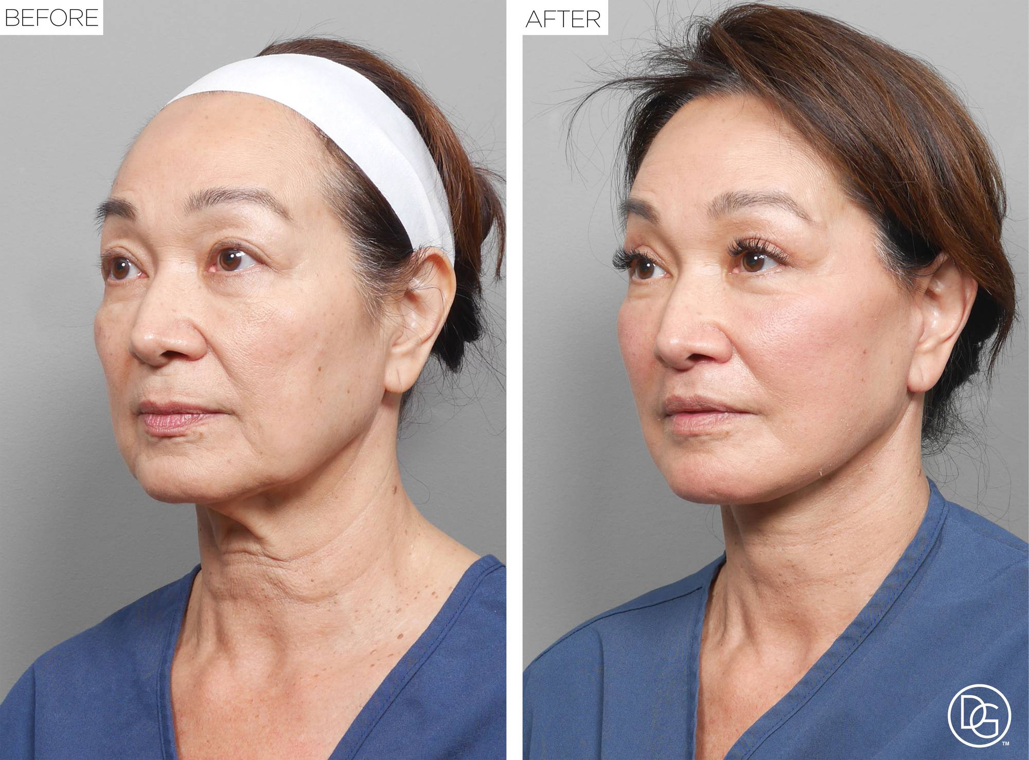 Before & After Image