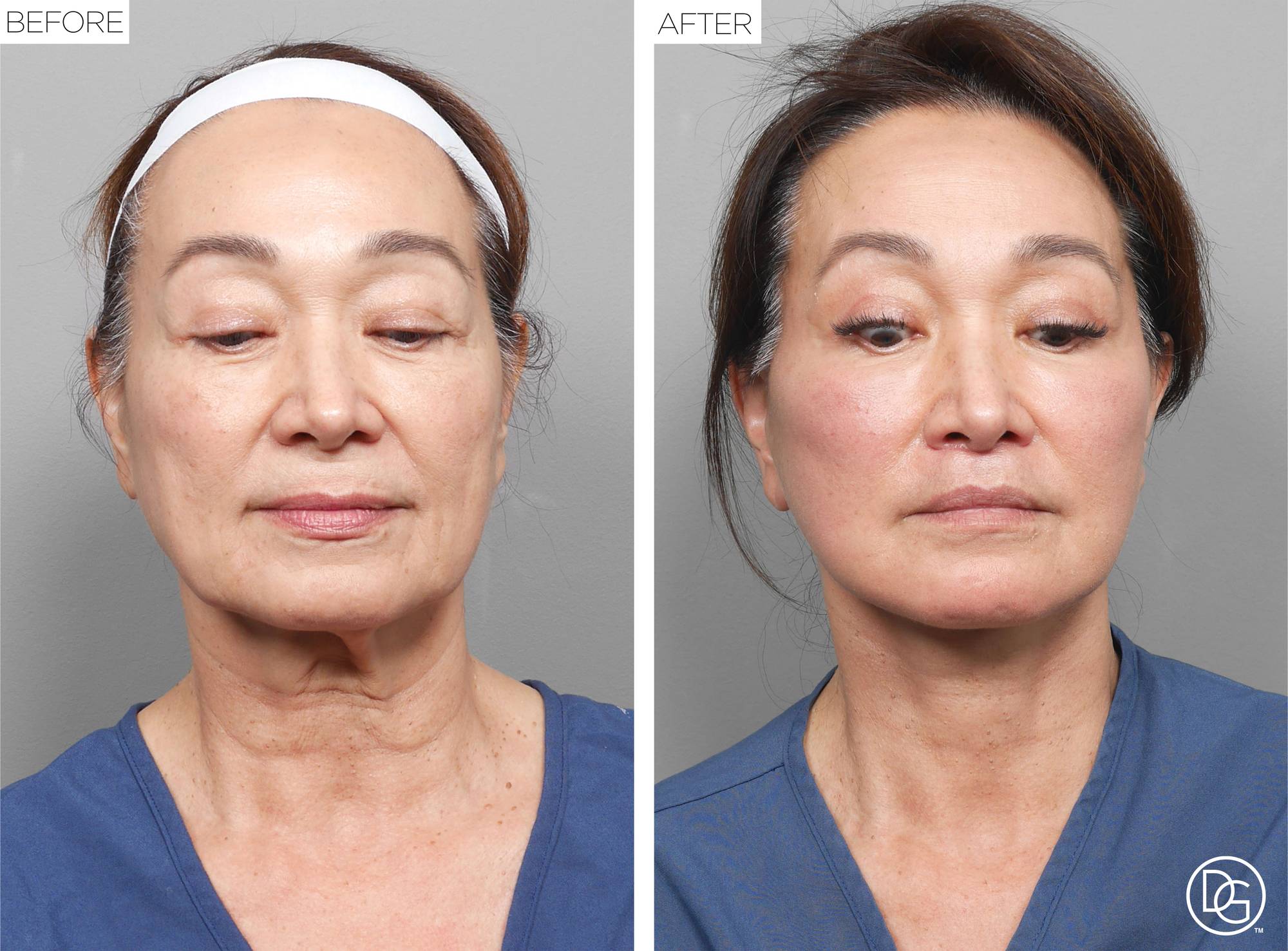 Before & After Image