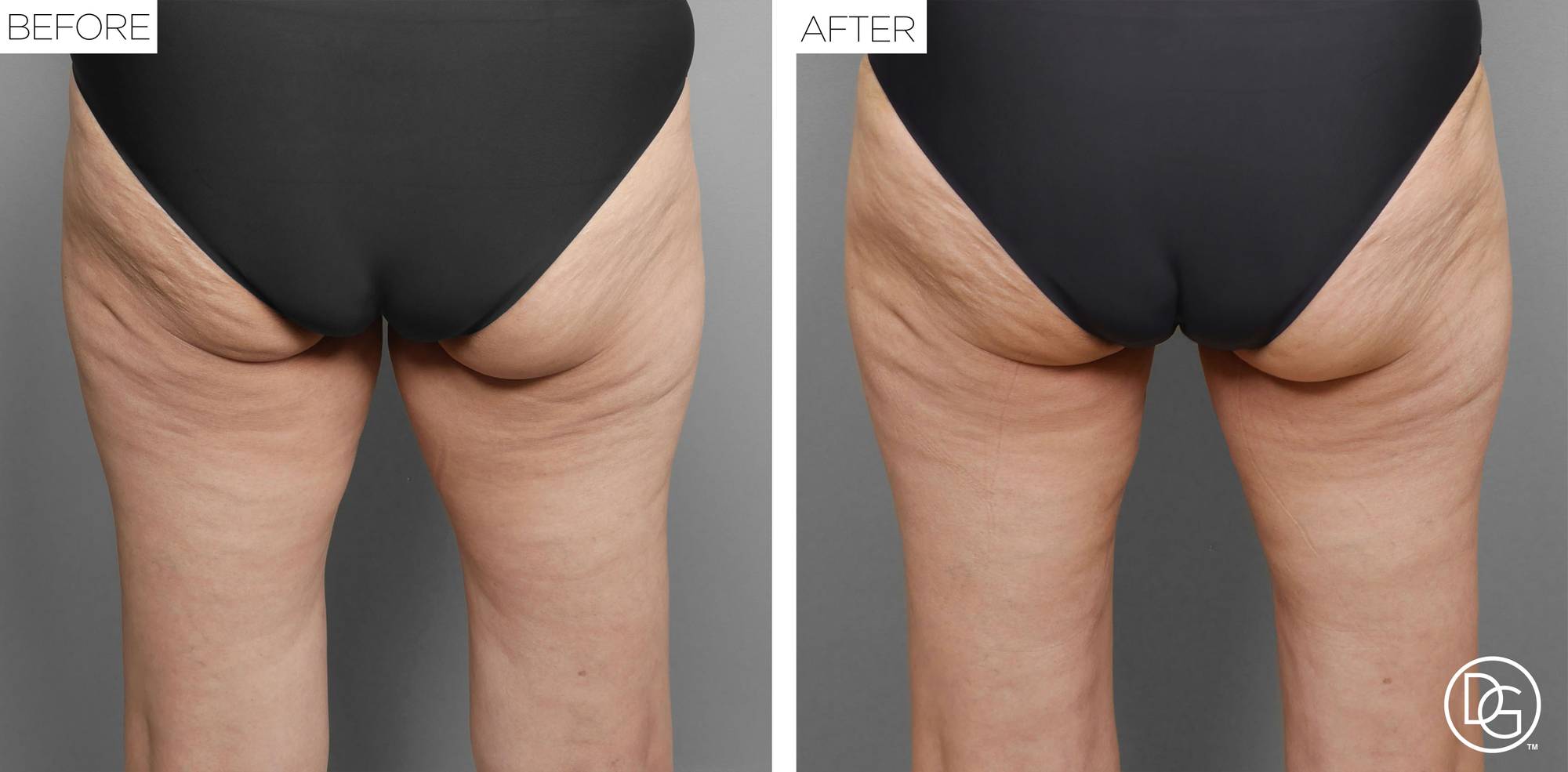 Before & After Image