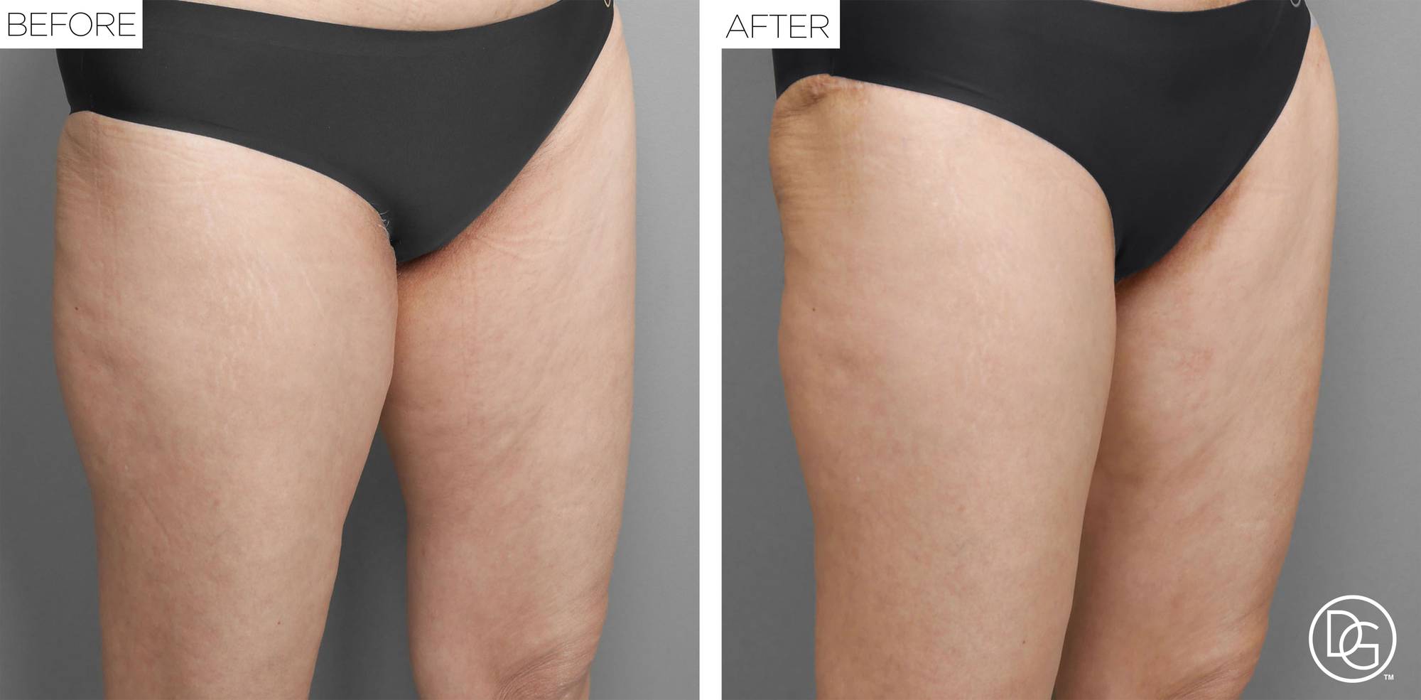 Before & After Image