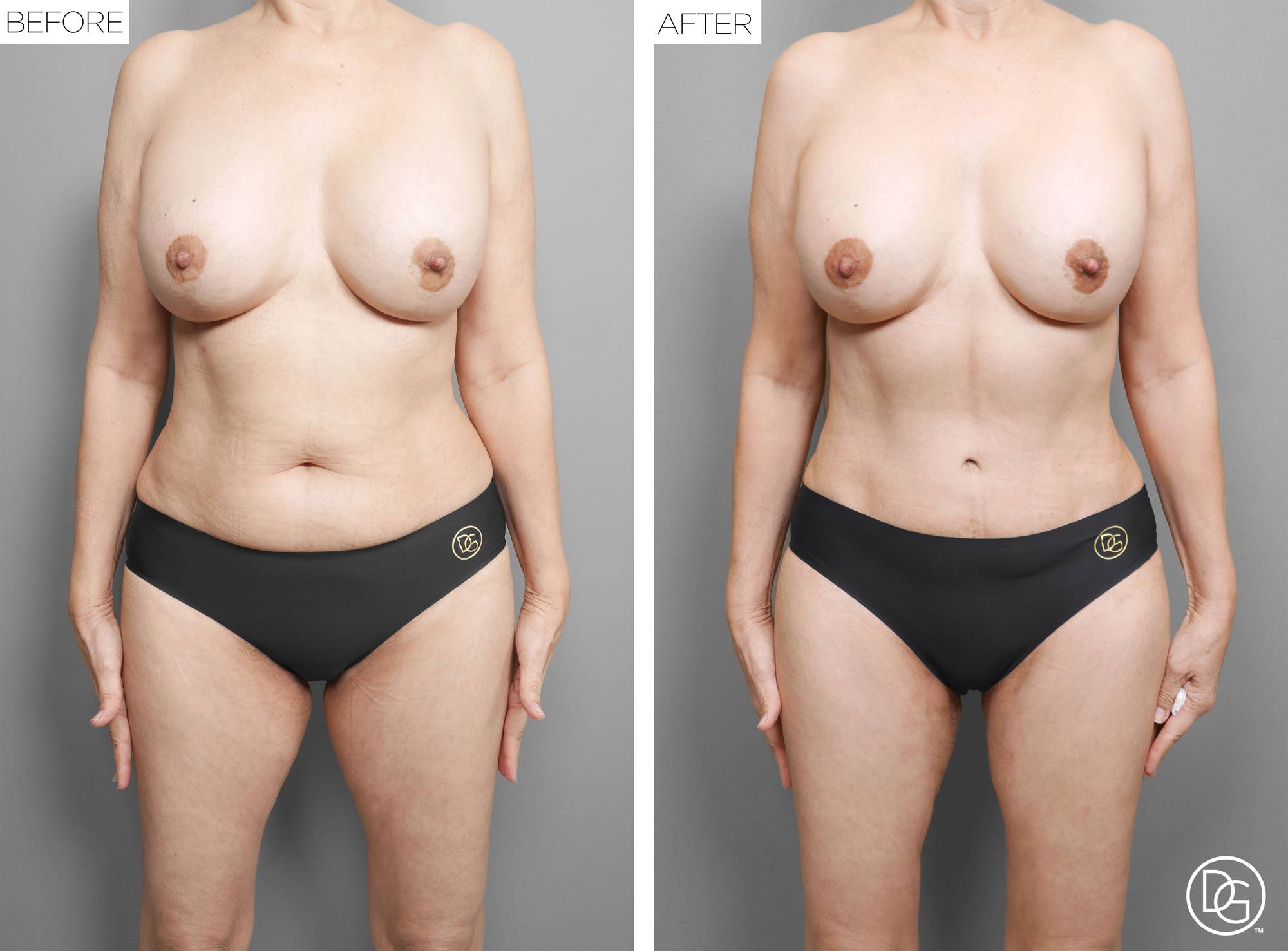 Before & After Image