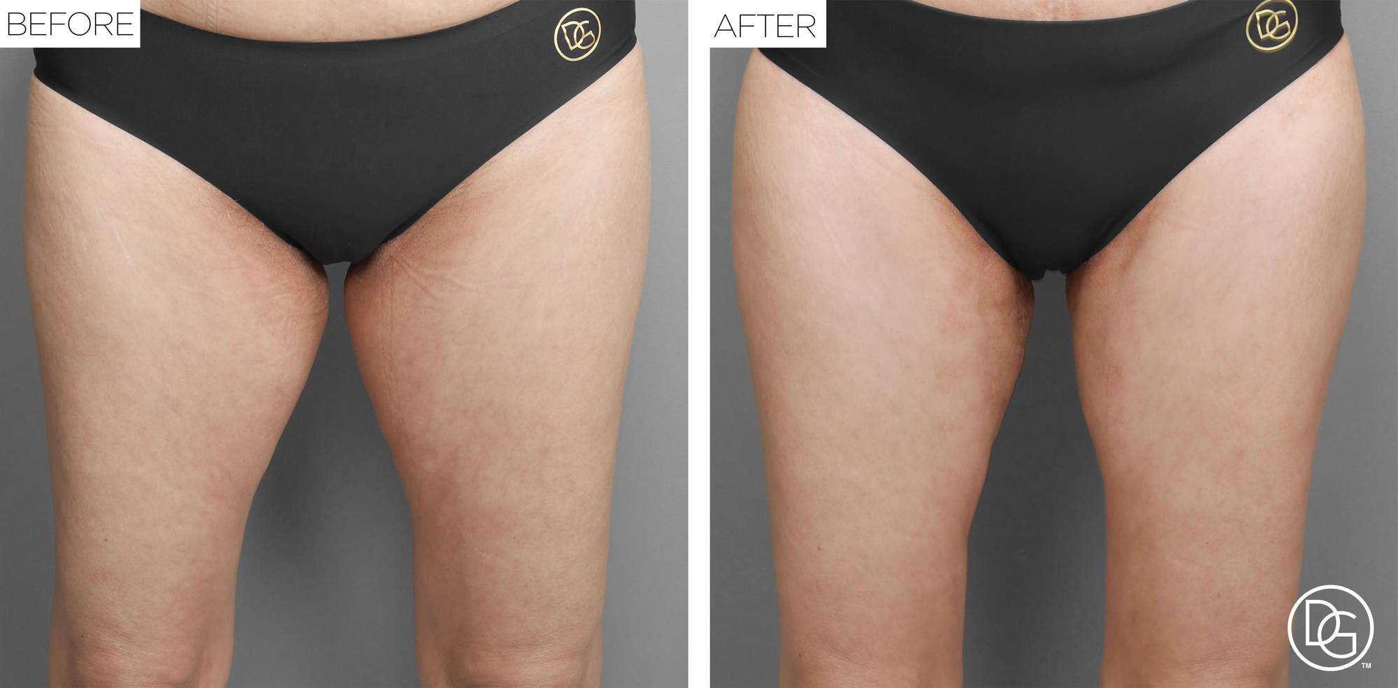 Before & After Image