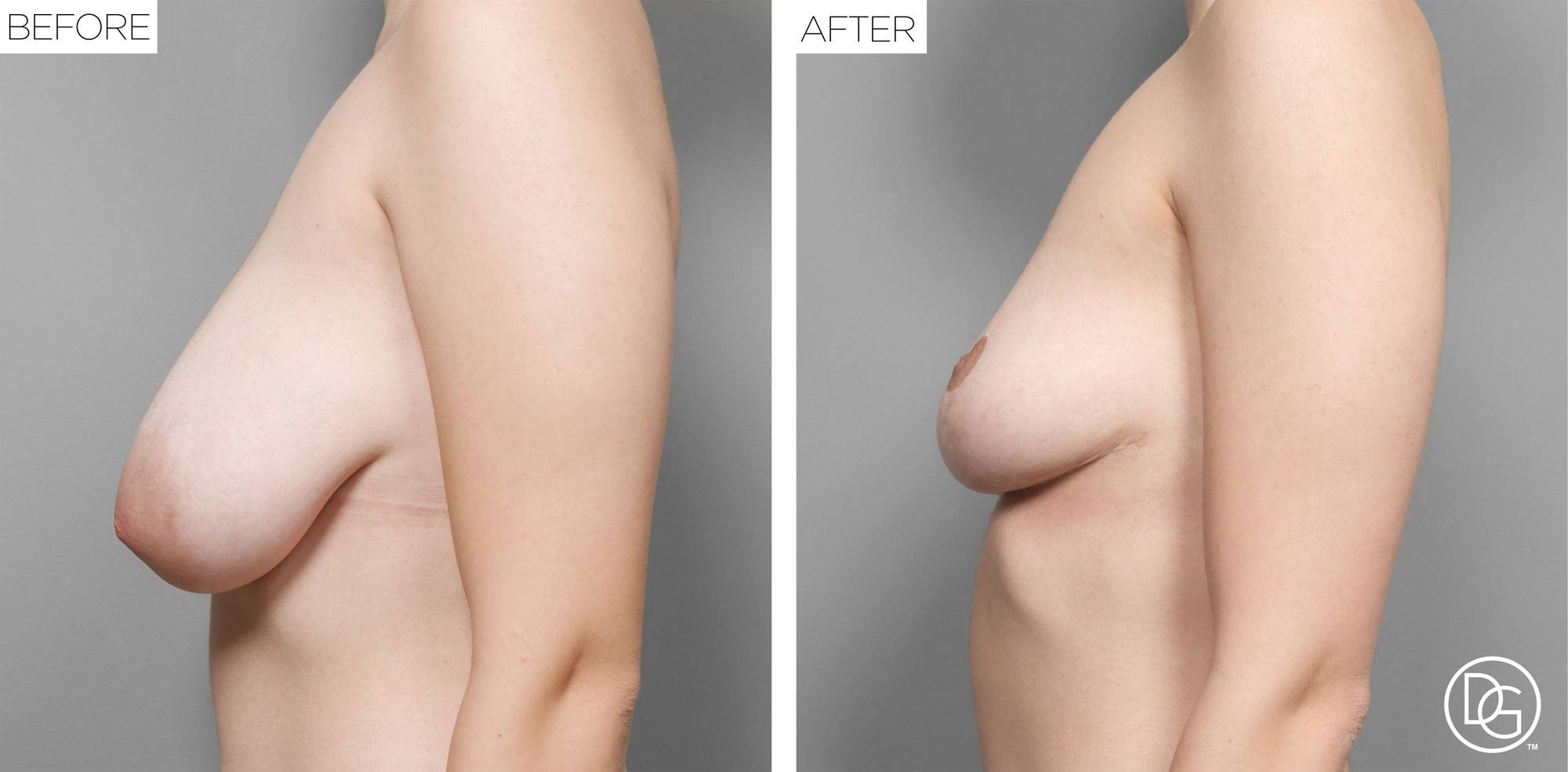 Before & After Image