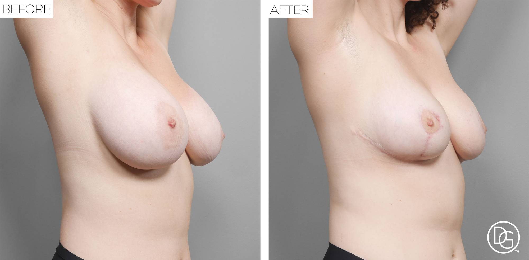 Before & After Image