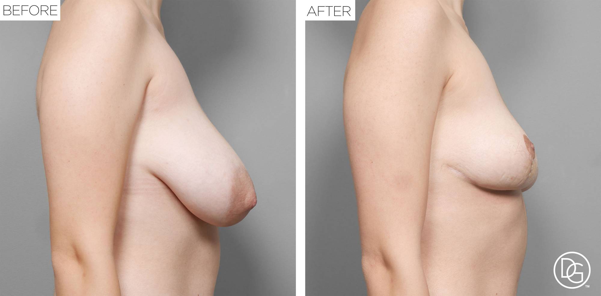 Before & After Image