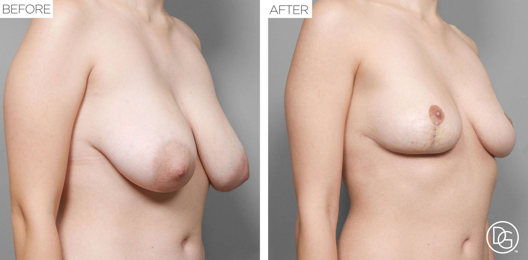 Before & After Image