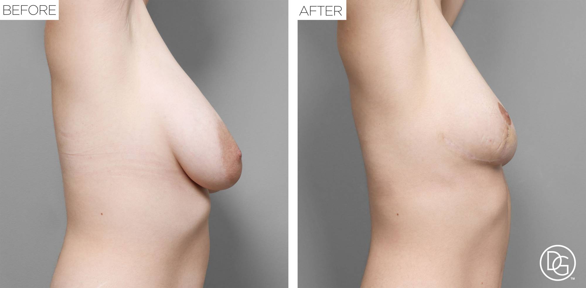 Before & After Image