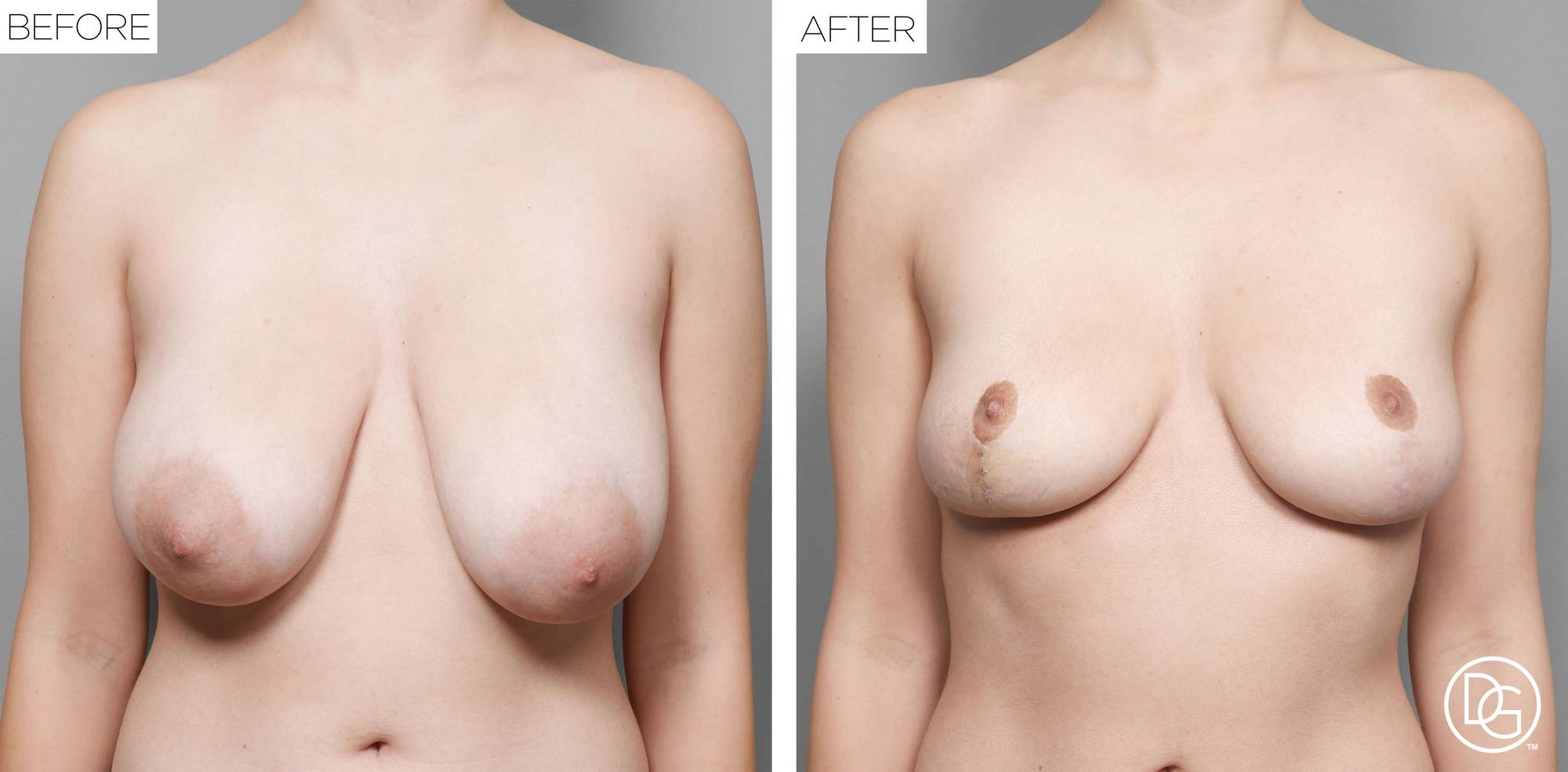 Before & After Image