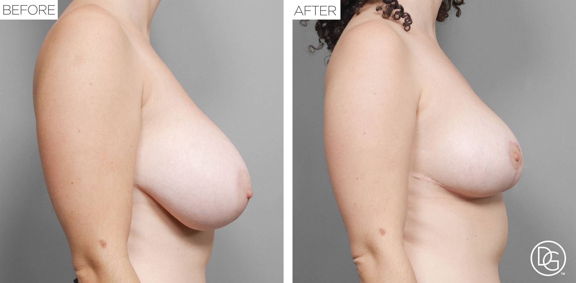 Before & After Image