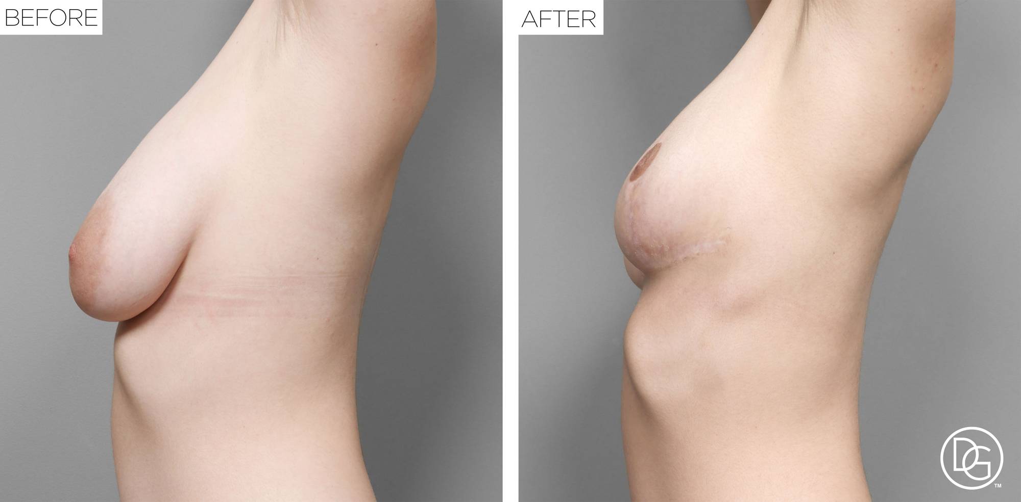 Before & After Image