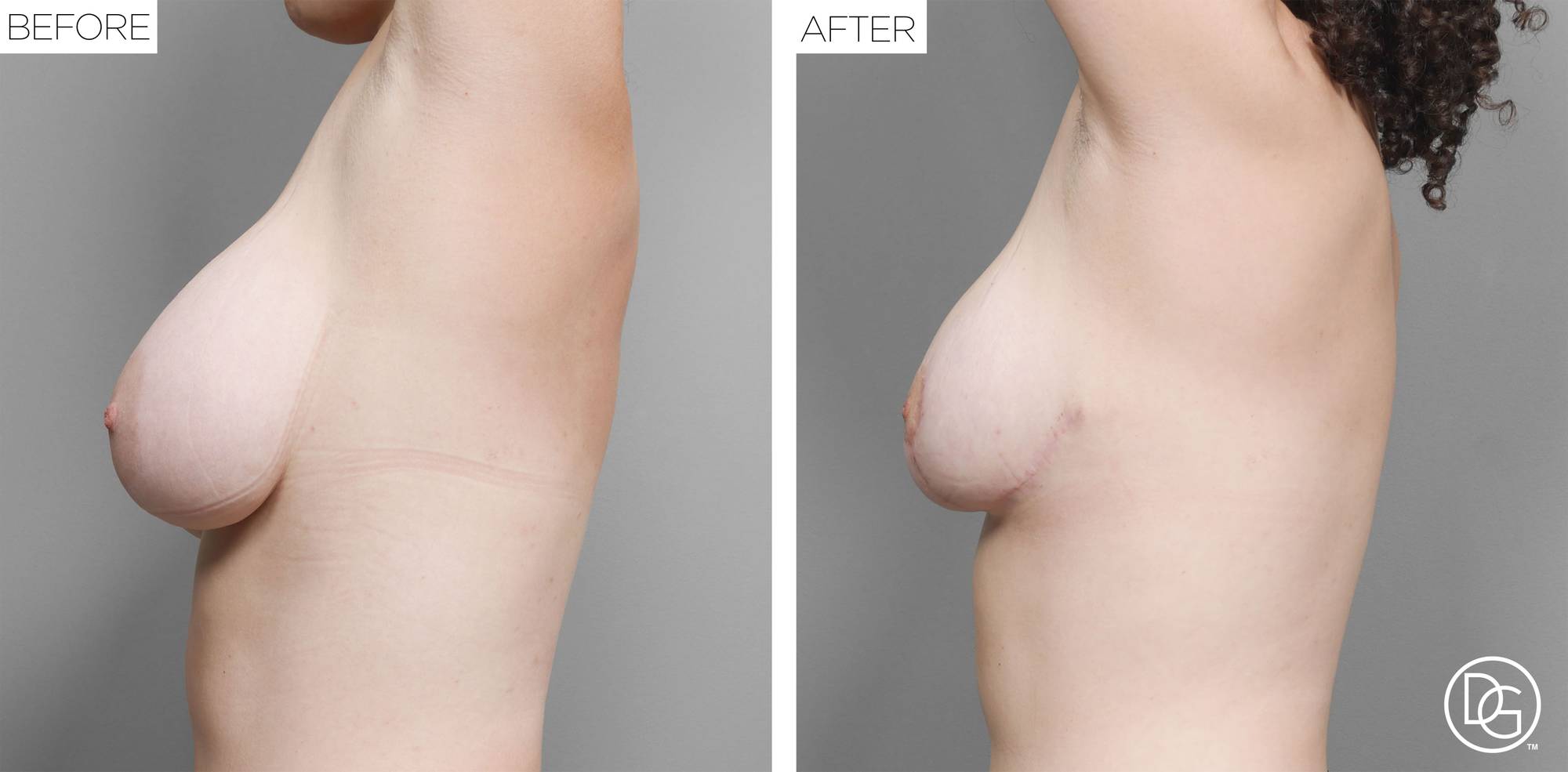 Before & After Image