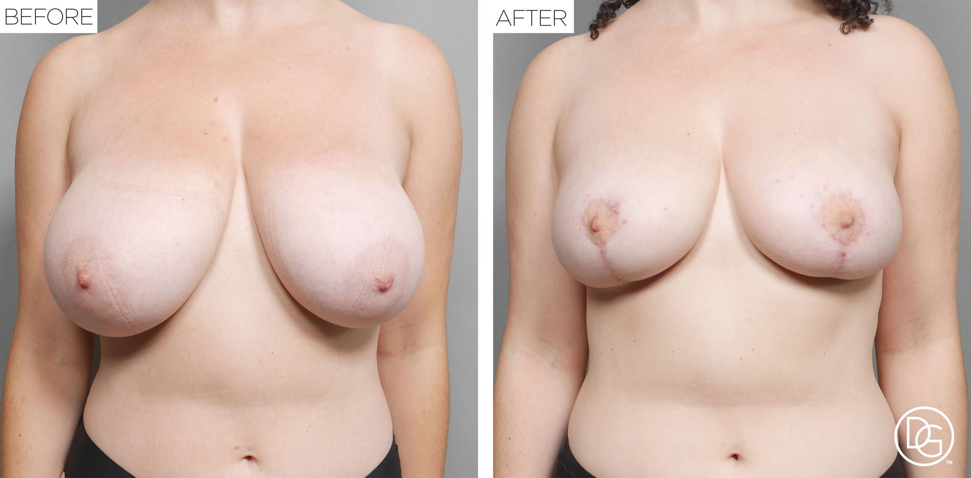 Before & After Image