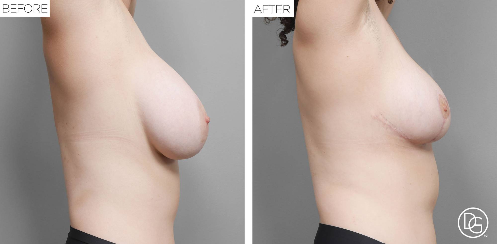 Before & After Image