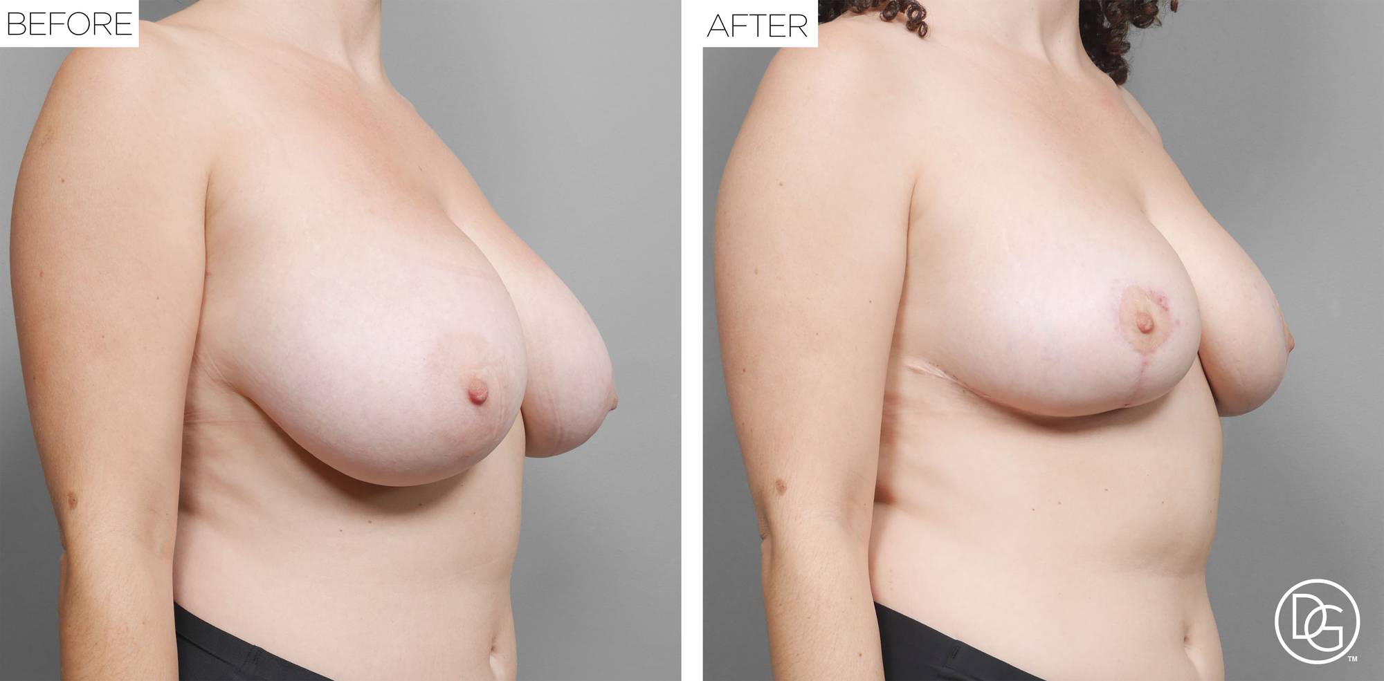 Before & After Image