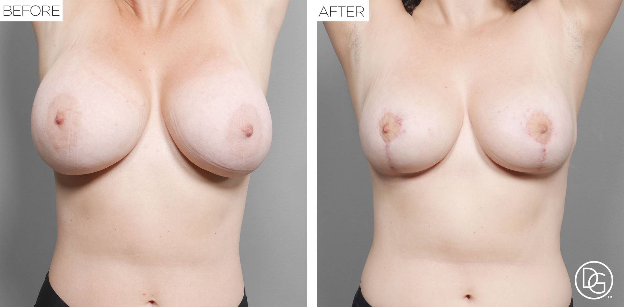 Before & After Image