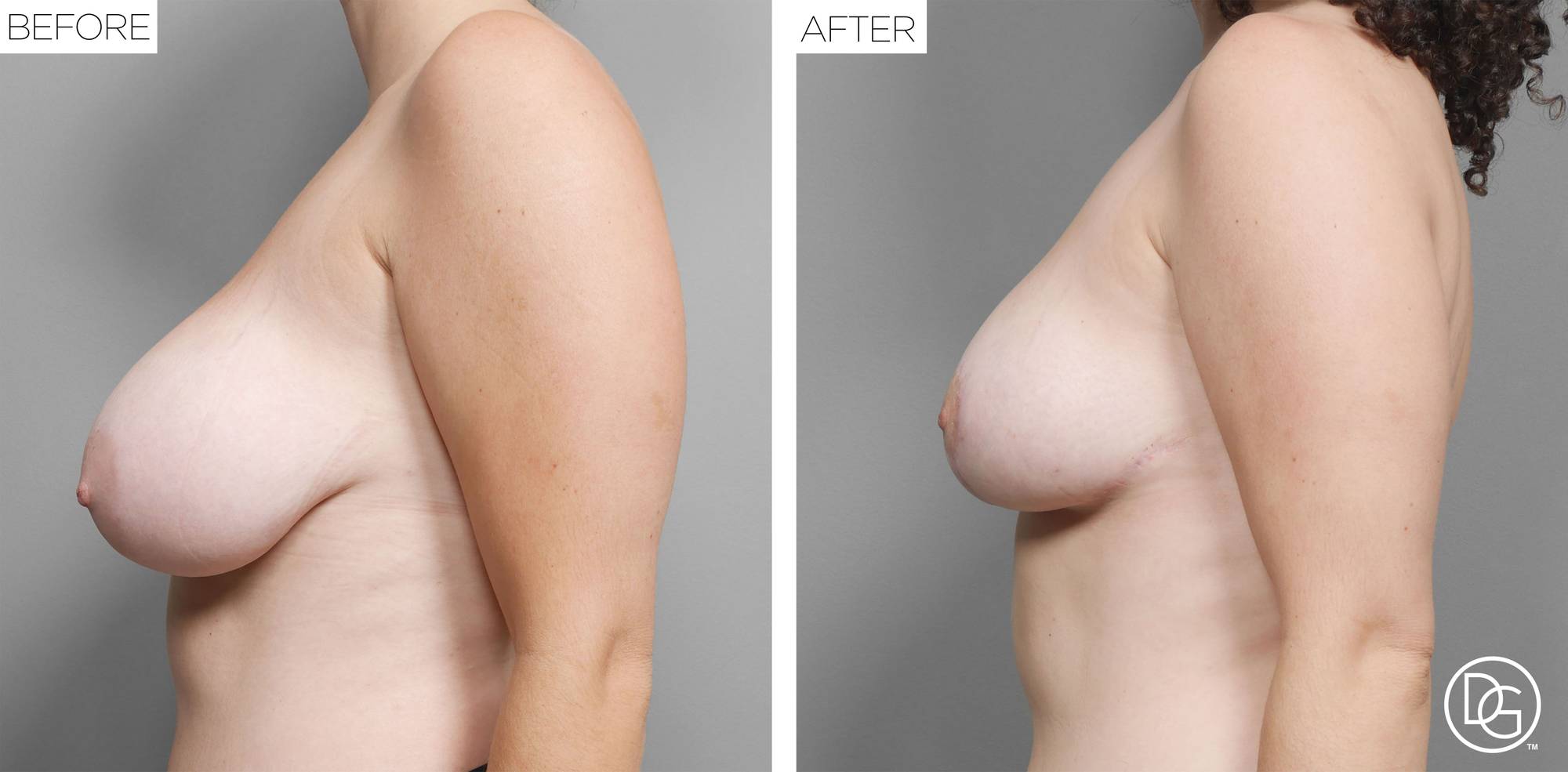 Before & After Image