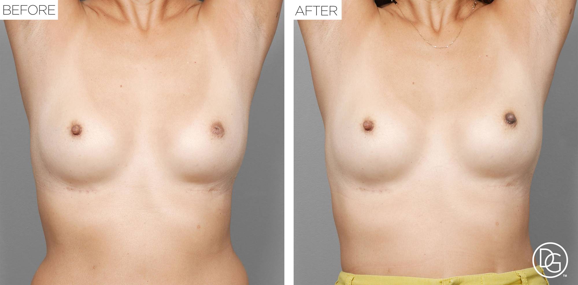 Before & After Image