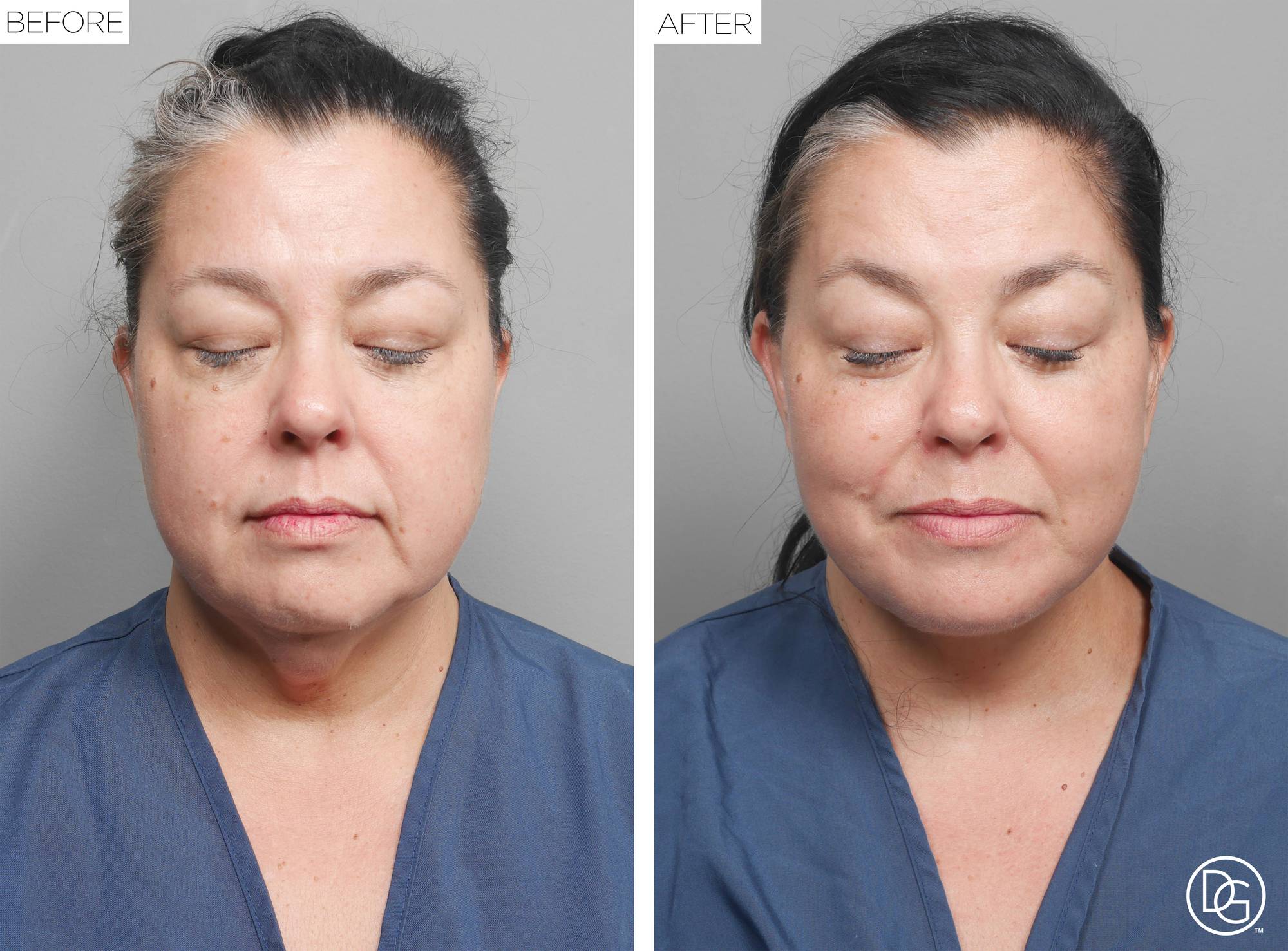 Before & After Image