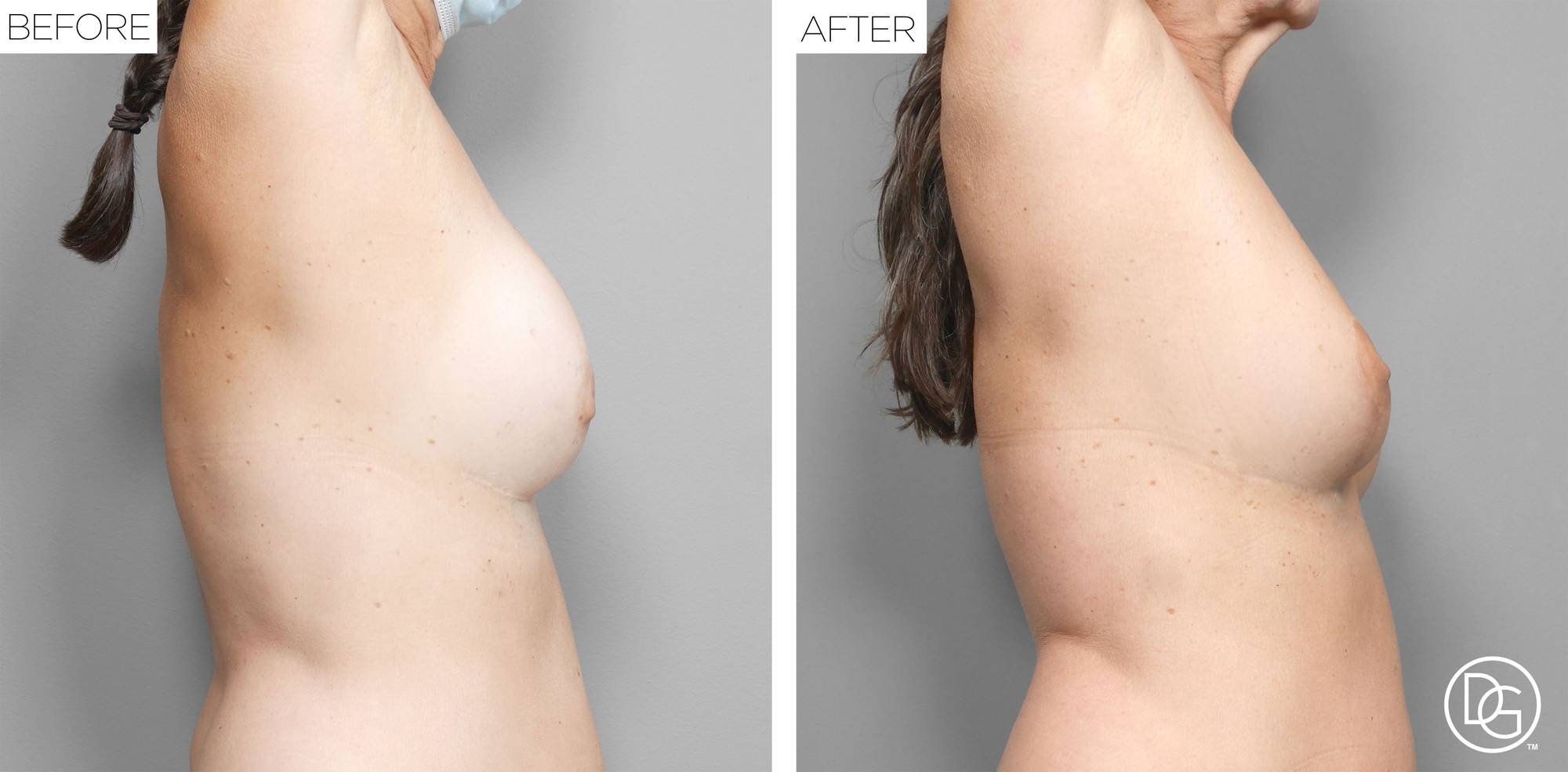 Before & After Image