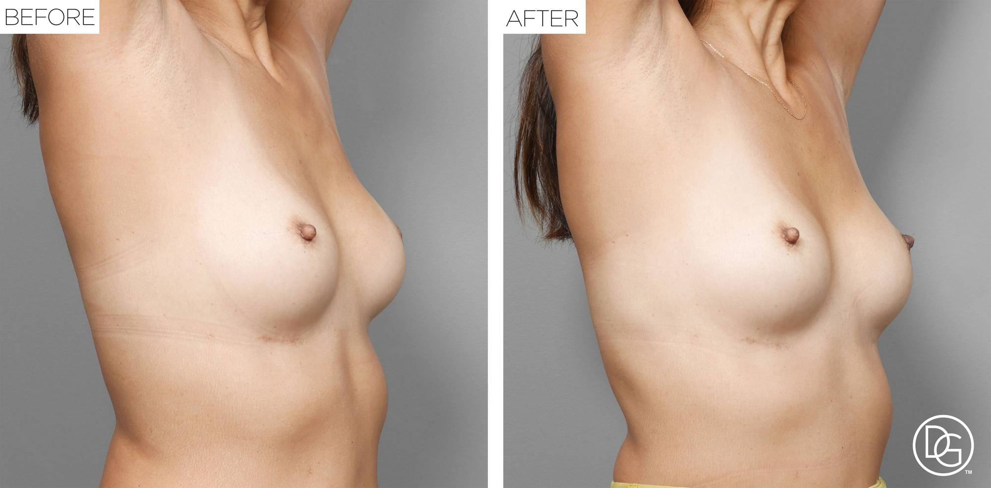 Before & After Image