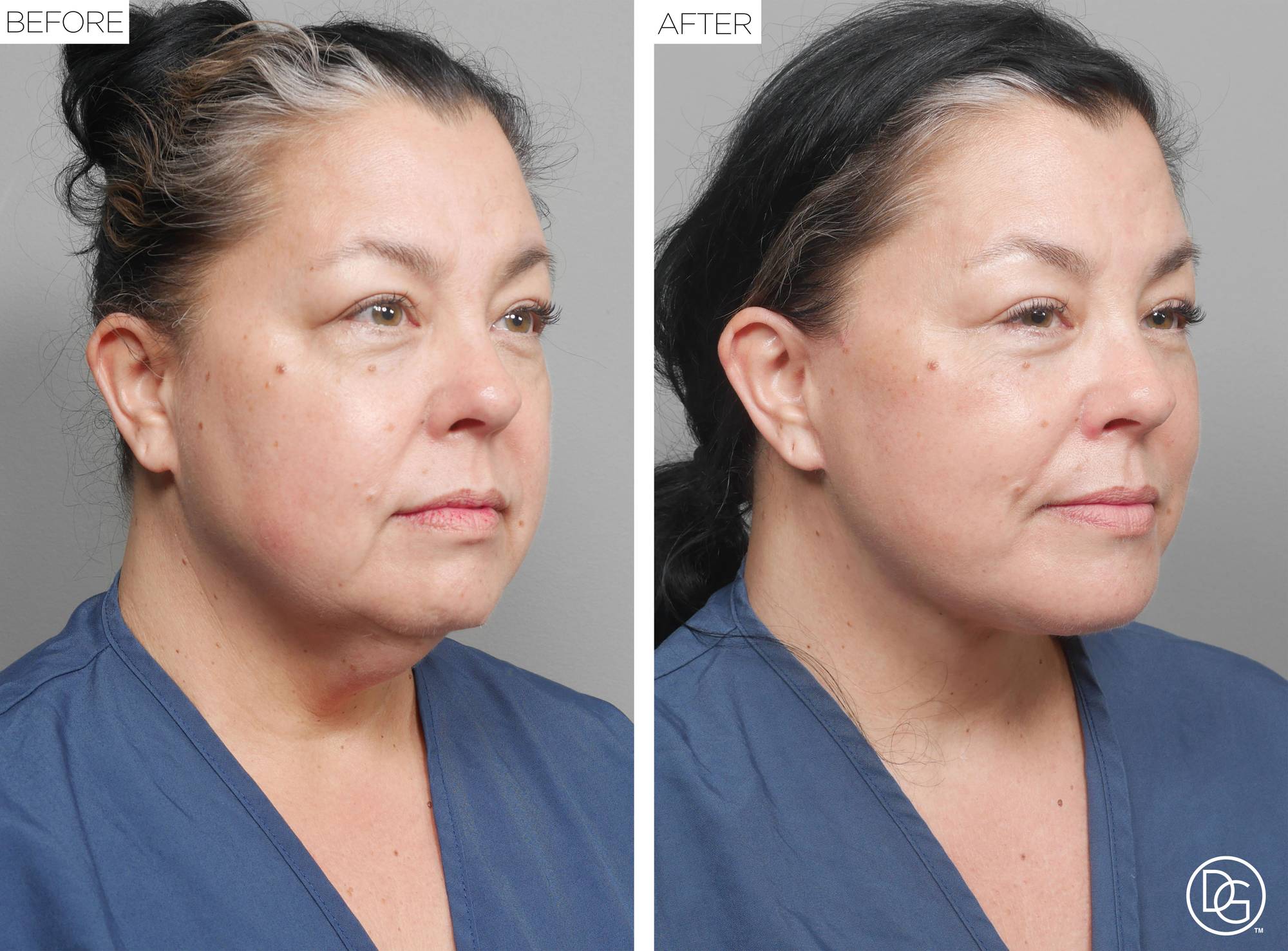 Before & After Image