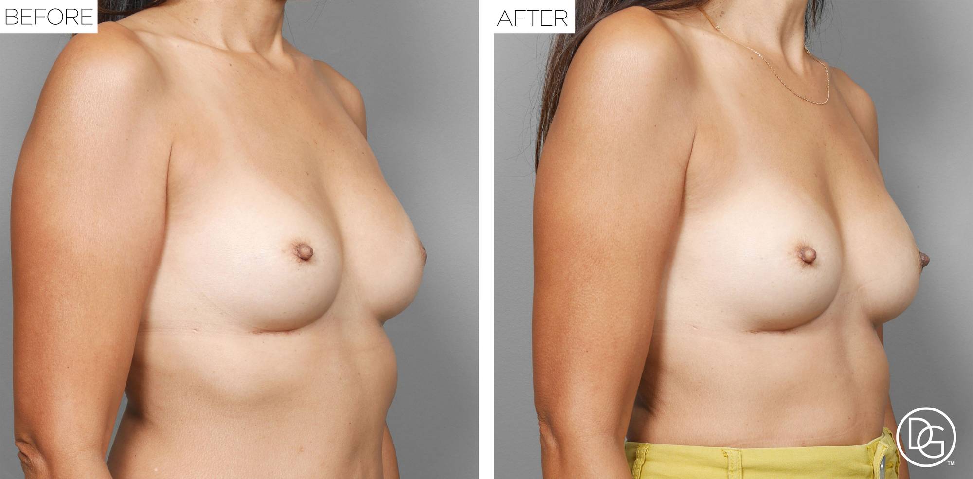 Before & After Image