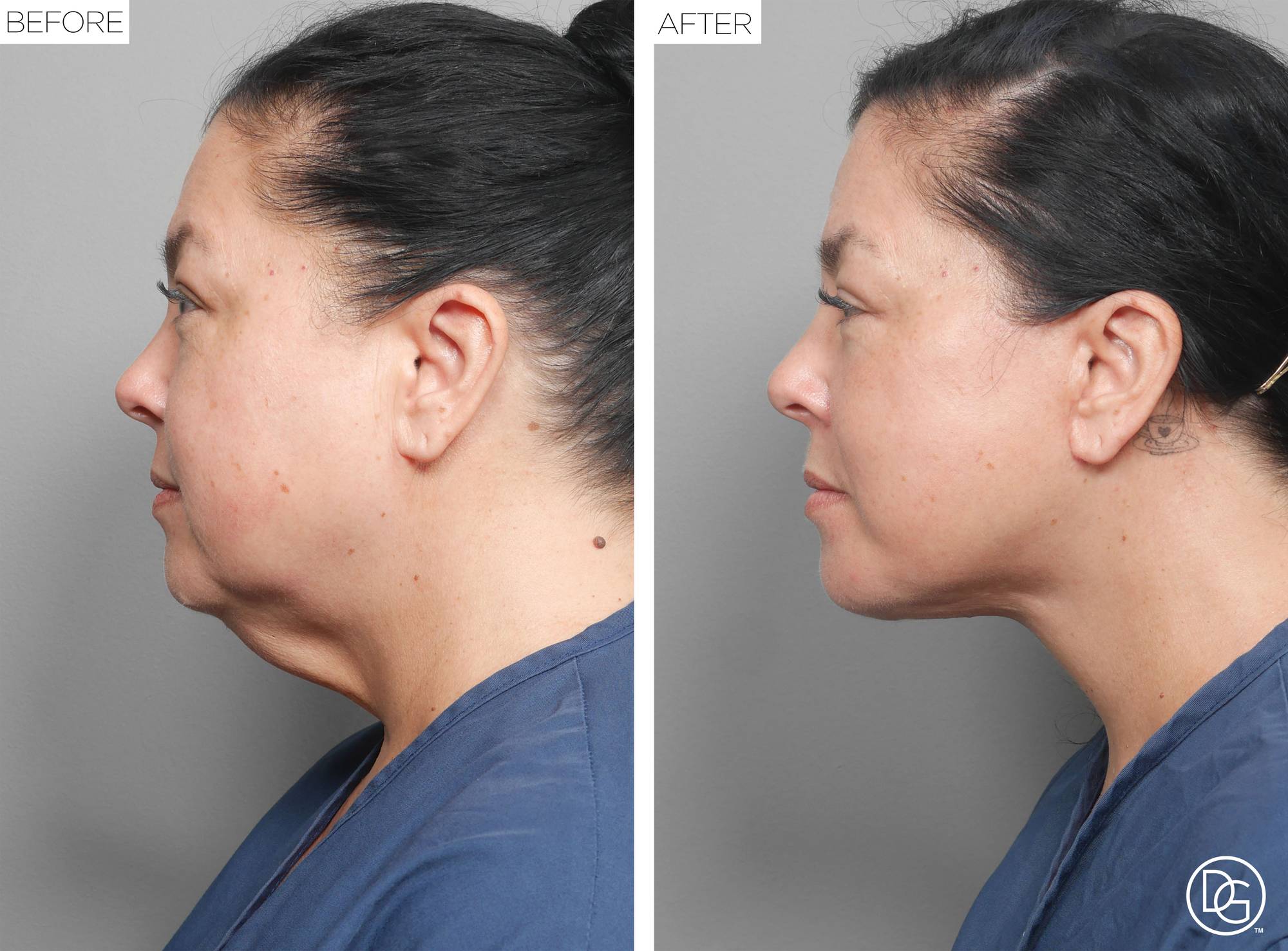 Before & After Image