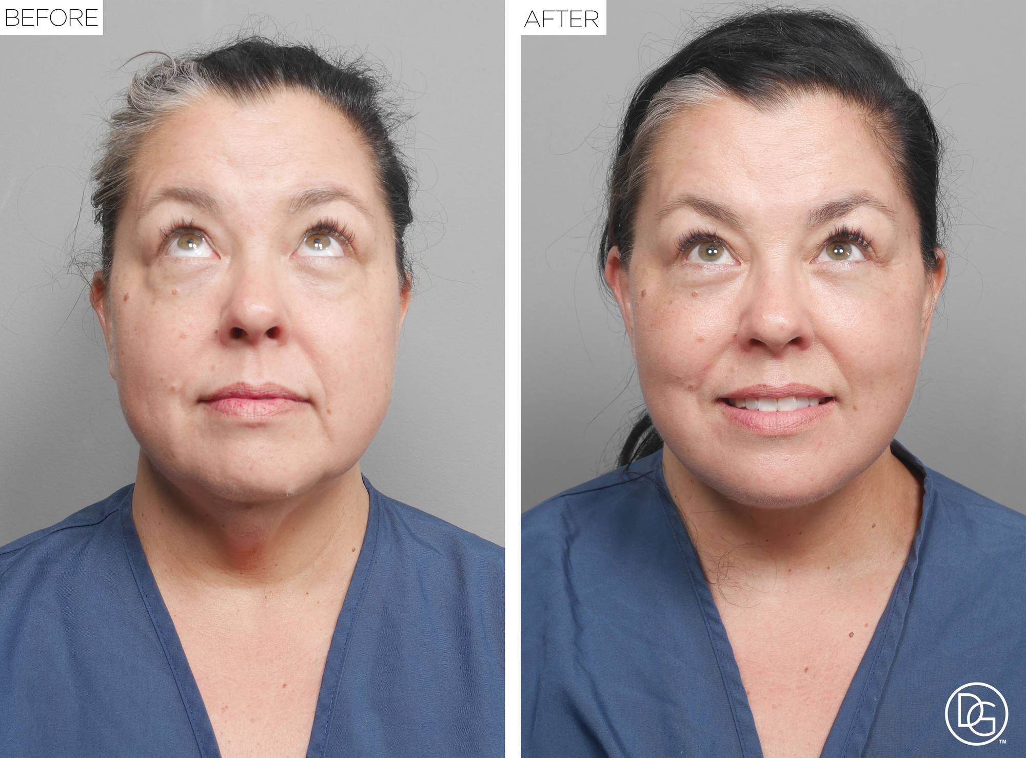 Before & After Image