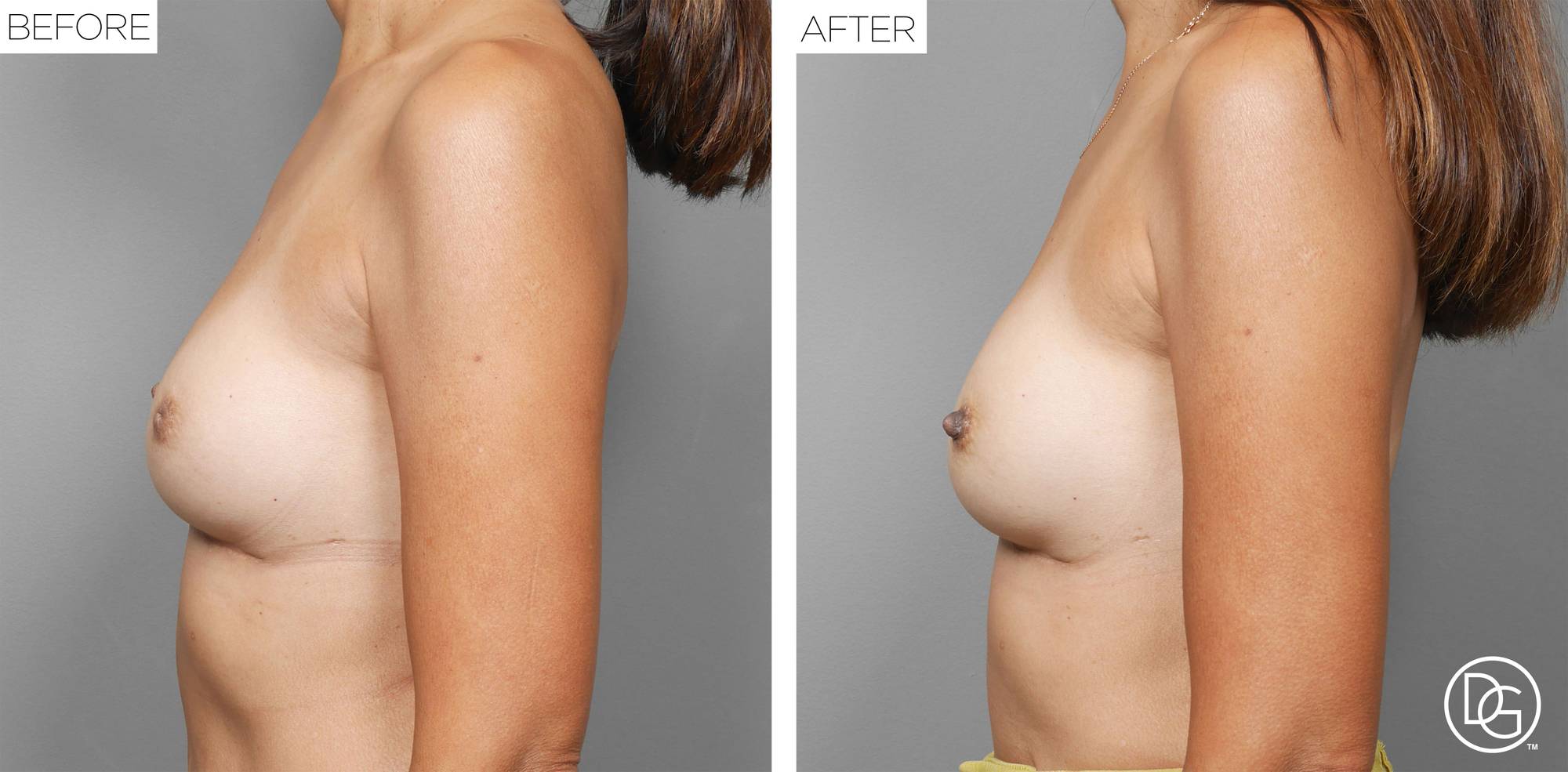 Before & After Image