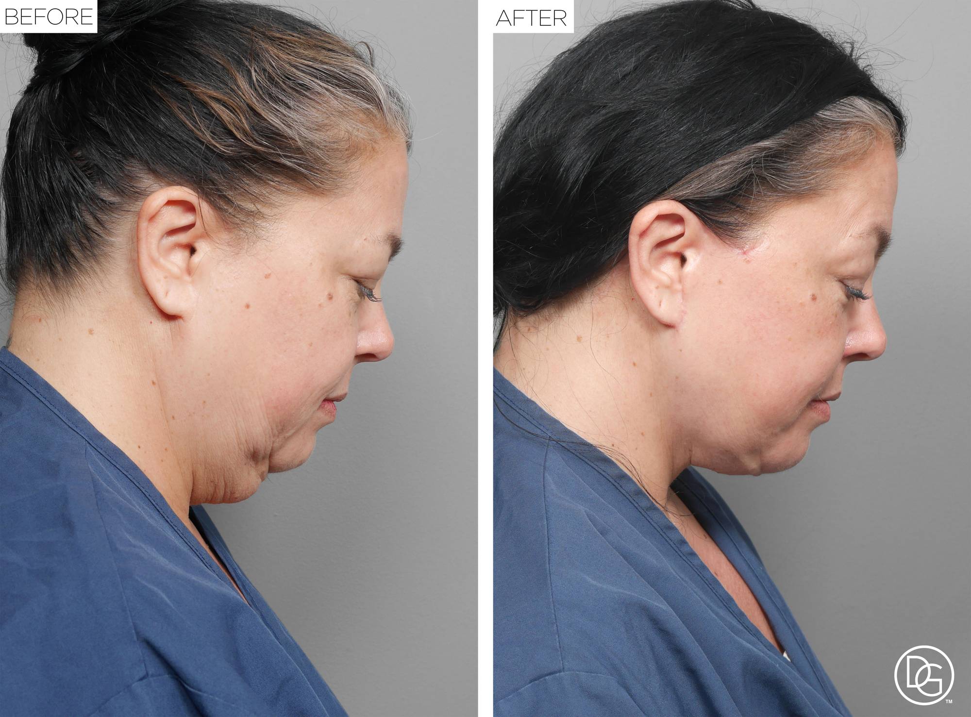 Before & After Image