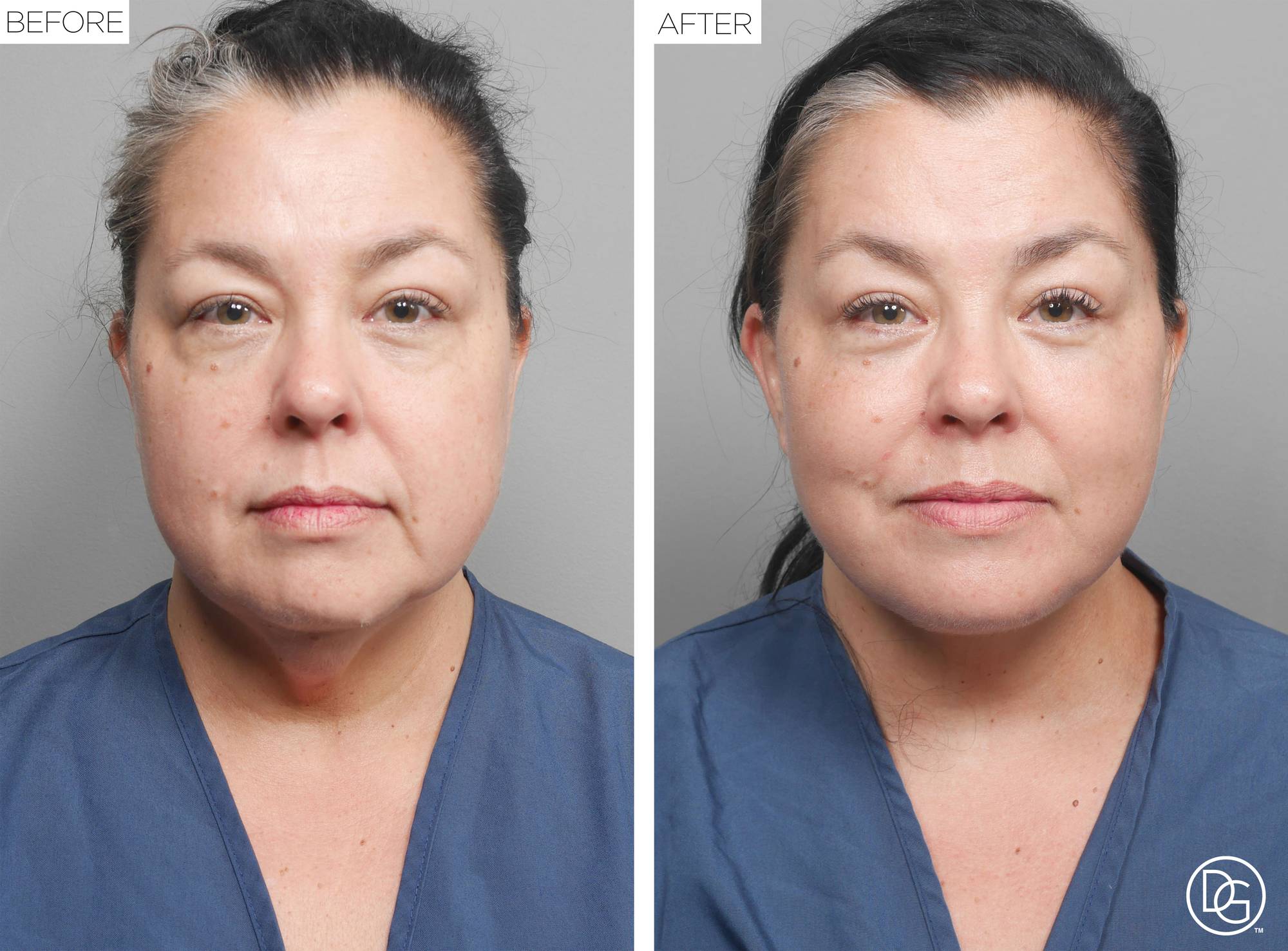 Before & After Image